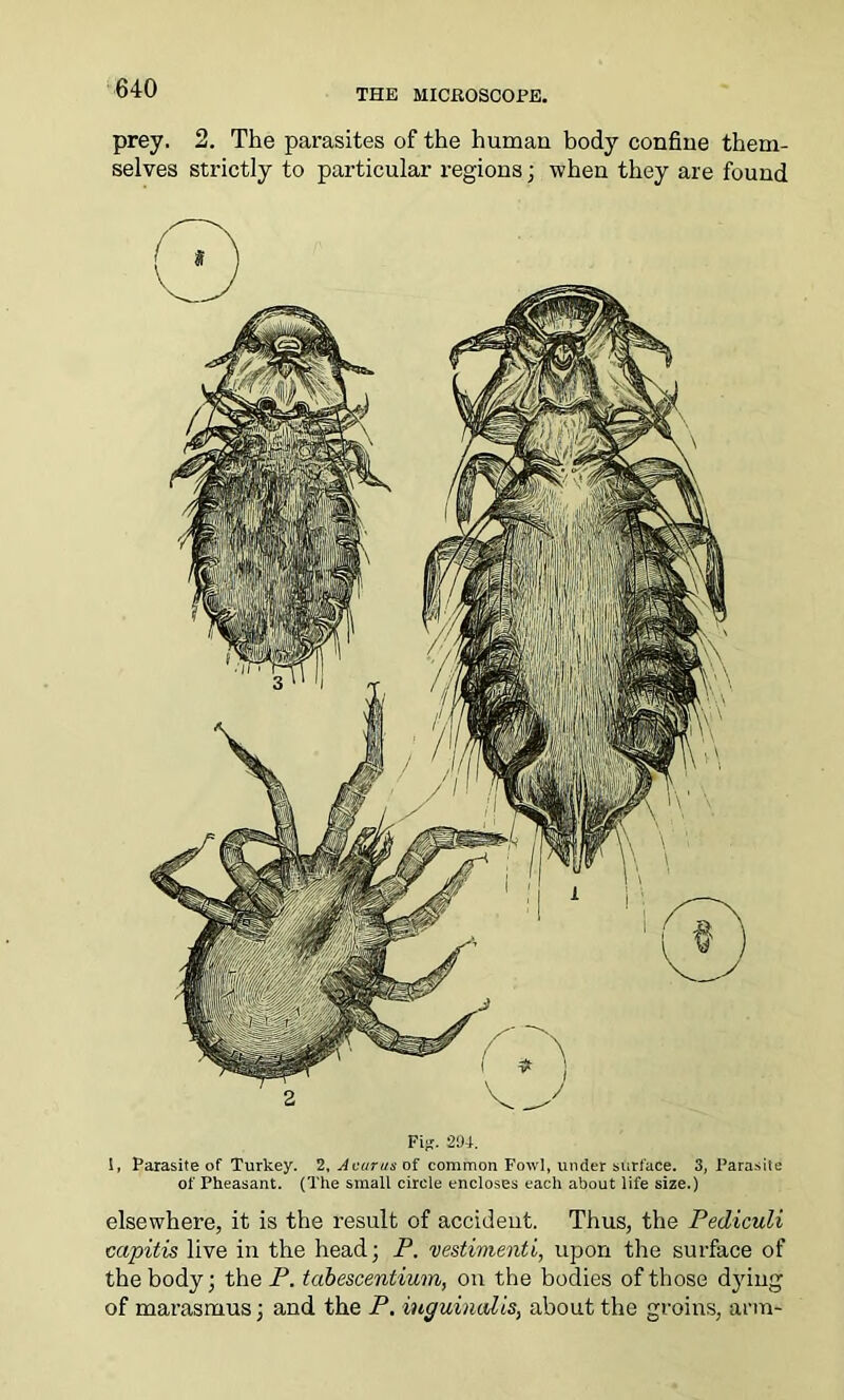 prey. 2. The parasites of the human body confine them- selves strictly to particular regions; when they are found Pijj. 294. 1, Parasite of Turkey. 2, Acar-us of common Fowl, under surface. 3, Parasite of Pheasant. (The small circle encloses each about life size.) elsewhere, it is the result of accident. Thus, the Pediculi capitis live in the head; P. vestimenti, upon the surface of the body; the P. tabescentium, on the bodies of those dyiug of marasmus; and the P. inguinalis, about the groins, arm-