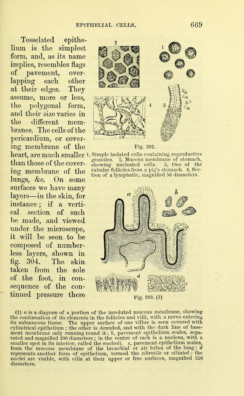 Tesselated epithe- lium is the simplest form, and, as its name implies, resembles flags of pavement, over- lapping each other at their edges. They assume, more or less, the polygonal form, and their size varies in the different mem- branes. The cells of the pericardium, or cover- ing membrane of the heart, are much smaller 1 than those of the cover- ing membrane of the lungs, &c. On some surfaces we have many layers—in the skin, for instance; if a verti- cal section of such be made, and viewed under the microscope, it will be seen to be composed of number- less layers, shown in fig. 304. The skin taken from the sole of the foot, in con- sequence of the con- tinued pressure there Simple isolated cells containing reproductive granules. 2, Mucous membrane of stomach, showing nucleated cells. 3, One of the tubular follicles from a pig’s stomach. 4, Sec- tion of a lymphatic, magnified 50 diameters. (1) a is a diagram of a portion of the involuted mucous membrane, showing the continuation of its elements in the follicles and villi, with a nerve entering its submucous tissue. The upper surface of one villus is seen covered with cylindrical epithelium ; the other is denuded, and with the dark line of base- ment membrane only running round it: 6, pavement epithelium scales, sepa- rated and magnified 200 diameters; in the centre of each is a nucleus, with a smaller spot in its interior, called the nucleoli, c, pavement epithelium scales, from the mucous membrane of the bronchial or air tubes of the lung; d represents another form of epithelium, termed the vibratile or ciliated; the nuclei are visible, with cilia at their upper or free surfaces, magnified 250 diameters.