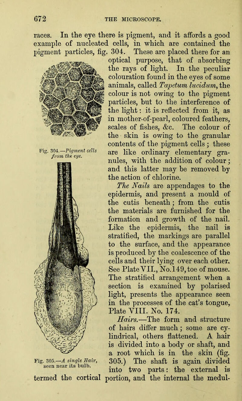 304. —Pigment cells from the eye. races. In the eye there is pigment, and it affords a good example of nucleated cells, in which are contained the pigment particles, fig. 304. These are placed there for an optical purpose, that of absorbing the rays of light. In the peculiar colouration found in the eyes of some animals, called Tapetum lucidum, the colour is not owing to the pigment particles, but to the interference of the light: it is reflected from it, as in mother-of-pearl, coloured feathers, scales of fishes, &c. The colour of the skin is owing to the granular contents of the pigment cells ; these are like ordinary elementary gra- nules, with the addition of colour; and this latter may be removed by the action of chlorine. The Nails are appendages to the epidermis, and present a mould of the cutis beneath; from the cutis the materials are furnished for the formation and growth of the nail. Like the epidermis, the nail is stratified, the markings are parallel to the surface, and the appearance is produced by the coalescence of the cells and their lying over each other. See Plate VII., No. 149, toe of mouse. The stratified arrangement when a section is examined by polarised light, presents the appearance seen in the processes of the cat’s tongue, Plate VIII. No. 174. Hairs.—The form and structure of hairs differ much; some are cy- lindrical, others flattened. A hair is divided into a body or shaft, and a root which is in the skin (fig. 305.) The shaft is again divided into two parts: the external is termed the cortical portion, and the internal the medul- Fig. 305.—A single Hair, seen near its bulb.