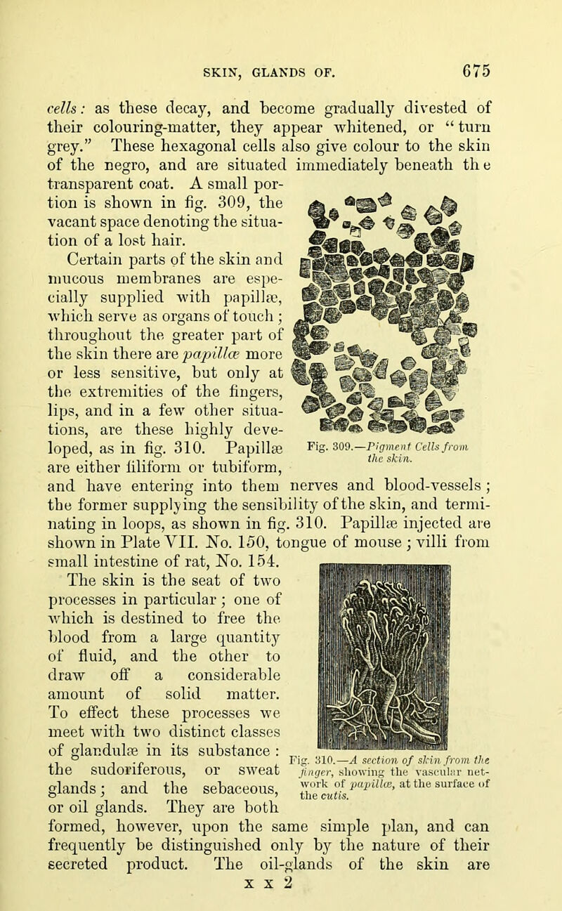 SKIN, GLANDS OF. Fig. 309.—Pigment Cells from the skin. cells: as these decay, and become gradually divested of their colouring-matter, they appear whitened, or “ turn grey.” These hexagonal cells also give colour to the skin of the negro, and are situated immediately beneath th e transparent coat. A small por- tion is shown in fig. 309, the vacant space denoting the situa- tion of a lost hair. Certain parts of the skin and mucous membranes are espe- cially supplied with papillae, which serve as organs of touch ; throughout the greater part of the skin there are papillce more or less sensitive, but only at the extremities of the fingers, lips, and in a few other situa- tions, are these highly deve- loped, as in fig. 310. Papillae are either filiform or tubiform, and have entering into them nerves and blood-vessels ; the former supplying the sensibility of the skin, and termi- nating in loops, as shown in fig. 310. Papillae injected are shown in Plate VII. No. 150, tongue of mouse ; villi from small intestine of rat, No. 154. The skin is the seat of two processes in particular ; one of which is destined to free the blood from a large quantity of fluid, and the other to draw off a considerable amount of solid matter. To effect these processes we meet with two distinct classes of glar.dulse in its substance : the sudoriferous, or sweat glands; and the sebaceous, or oil glands. They are both formed, however, upon the same simple plan, and can frequently be distinguished only by the nature of their secreted product. The oil-glands of the skin are x x 2 Fi 310.—A section of skin from the finger, showing the vascular net- work of papilla!, at the surface of the cutis.