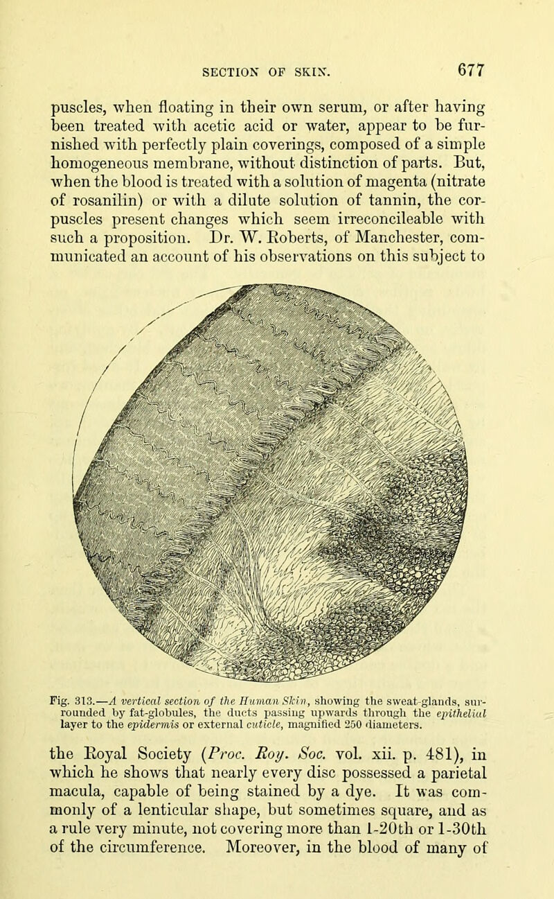 puscles, when floating in their own serum, or after having been treated with acetic acid or water, appear to be fur- nished writh perfectly plain coverings, composed of a simple homogeneous membrane, without distinction of parts. But, when the blood is treated with a solution of magenta (nitrate of rosanilin) or with a dilute solution of tannin, the cor- puscles present changes which seem irreconcileable with such a proposition. Dr. W. Roberts, of Manchester, com- municated an account of his observations on this subject to Fig. 313.—A vertical section of the Human Skin, showing the sweat-glands, sur- rounded by fat-globules, the ducts passing upwards through the epithelial layer to the epidermis or external cuticle, magnified 250 diameters. the Royal Society (Proc. Roy. Soc. vol. xii. p. 481), in which he shows that nearly every disc possessed a parietal macula, capable of being stained by a dye. It was com- monly of a lenticular shape, but sometimes square, and as a rule very minute, not covering more than l-20tli or l-30tli of the circumference. Moreover, in the blood of many of