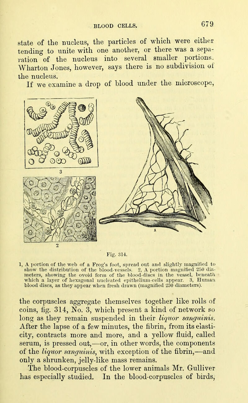BLOOD CELLS. state of the nucleus, the particles of which were either tending to unite with one another, or there was a sepa- ration of the nucleus into several smaller portions. Wharton Jones, however, says there is no subdivision oi the nucleus. If we examine a drop of blood under the microscope, 2 Fig. 314. 1, A portion of the web of a Frog's foot, spread out ami slightly magnified to show the distribution of the blood-vessels. 2, A portion magnified 250 dia- meters, showing the ovoid form of the blood-discs in the vessel, beneath which a layer of hexagonal nucleated epithelium-cells appear. 3, Human blood discs, as they appear when fresh drawn (magnified 250 diameters). the corpuscles aggregate themselves together like rolls of coins, fig. 314, No. 3, which present a kind of network so long as they remain suspended in their liquor sanguinis. After the lapse of a few minutes, the fibrin, from its elasti- city, contracts more and more, and a yellow fluid, called serum, is pressed out,—or, in other words, the components of the liquor sanguinis, with exception of the fibrin,—and only a shrunken, jelly-like mass remains. The blood-corpuscles of the lower animals Mr. Gulliver has especially studied. In the blood-corpuscles of birds,