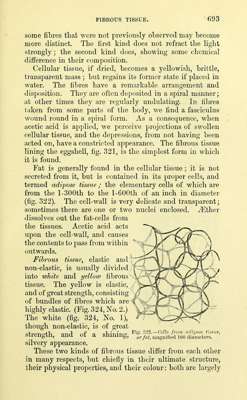 some fibres tliat were not previously observed may become more distinct. The first kind does not refract the light strongly; the second kind does, showing some chemical difference in their composition. Cellular tissue, if dried, becomes a yellowish, brittle, transparent mass ; but regains its former state if placed in water. The fibres have a remarkable arrangement and disposition. They are often deposited in a spiral manner; at other times they are regularly undulating. In fibres taken from some parts of the body, we find a fasciculus wound round in a spiral form. As a consequence, when acetic acid is applied, we perceive projections of swollen cellular tissue, and the depressions, from not having been acted on, have a constricted appearance. The fibrous tissue lining the eggshell, fig. 321, is the simplest form in which it is found. Fat is generally found in the cellular tissue; it is not secreted from it, but is contained in its proper cells, and termed adipose tissue; the elementary cells of which are from the 1-300th to the 1-600th of an inch in diameter (fig. 322). The cell-wall is very delicate and transparent; sometimes there are one or two nuclei enclosed. TEther dissolves out the fat-cells from the tissues. Acetic acid acts upon the cell-wall, and causes the contents to pass from within outwards. Fibrous tissue, elastic and non-elastic, is usually divided into white and yellow fibrous tissue. The yellow is elastic, and of great strength, consisting of bundles of fibres which are highly elastic. (Fig. 324, No. 2.) The white (fig. 324, No. 1), though non-elastic, is of great M ..pTiotli nnrl nf a sViinino- Fi& 322.—Cells from adipose tissue, sLienglU, anu 01 a sninmo, 0rfat, magnified 100 diameters. silvery appearance. These two kinds of fibrous tissue differ from each other in many respects, but chiefly in their ultimate structure, their physical properties, and their colour: both are largely