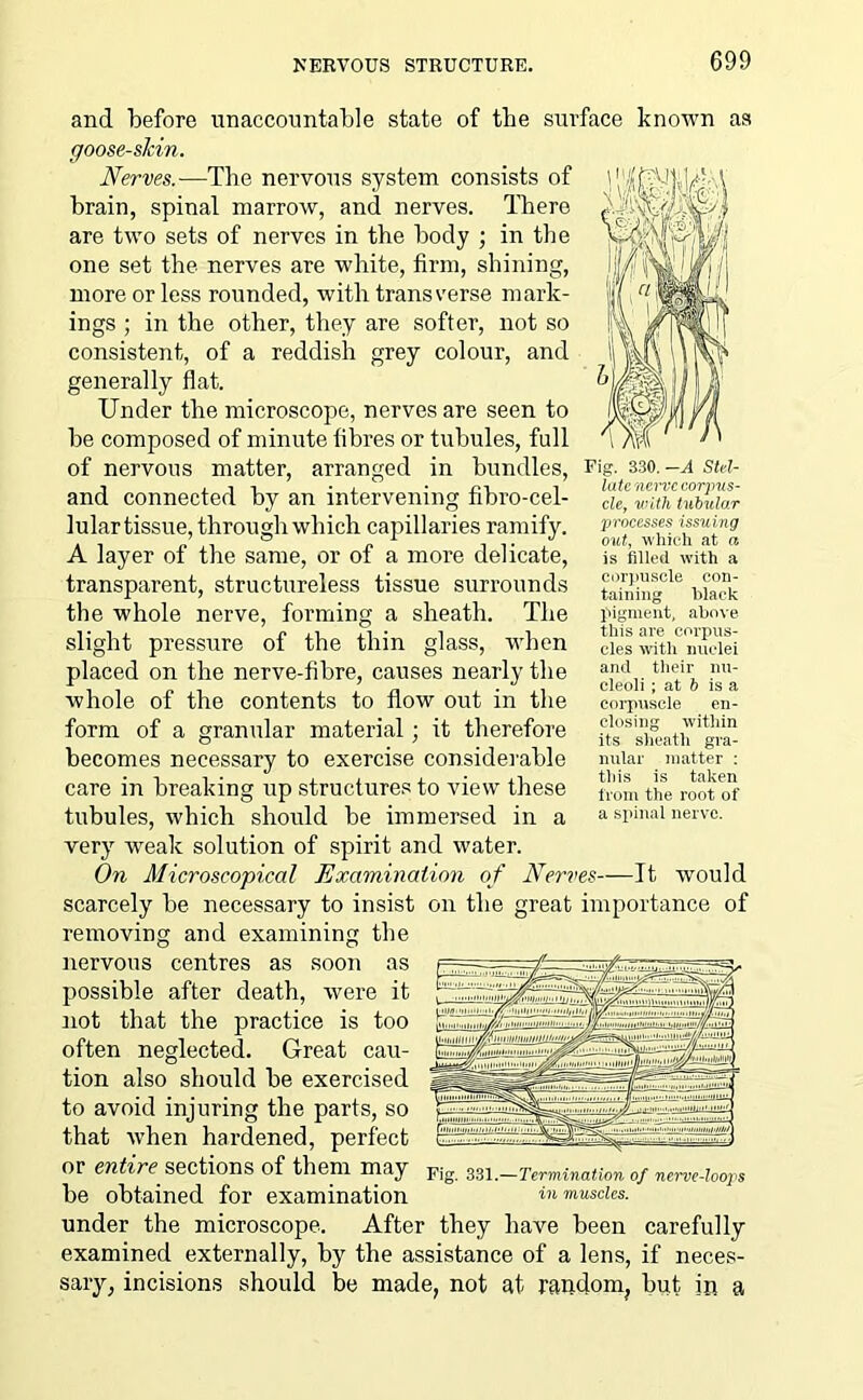 and before unaccountable state of tbe surface known as goose-slcin. Nerves.—The nervous system consists of brain, spinal marrow, and nerves. There are two sets of nerves in the body ; in the one set the nerves are white, firm, shining, more or less rounded, with transverse mark- ings ; in the other, they are softer, not so consistent, of a reddish grey colour, and generally flat. Under the microscope, nerves are seen to be composed of minute fibres or tubules, full of nervous matter, arranged in bundles, and connected by an intervening fibro-cel- lular tissue, through which capillaries ramify. A layer of the same, or of a more delicate, transparent, structureless tissue surrounds the whole nerve, forming a sheath. The slight pressure of the thin glass, when placed on the nerve-fibre, causes nearly the whole of the contents to flow out in the form of a granular material; it therefore becomes necessary to exercise considerable care in breaking up structures to view these tubules, which should be immersed in a very weak solution of spirit and water. On Microscopical Examination of Nerves—It would scarcely be necessary to insist on the great importance of removing and examining the nervous centres as soon as possible after death, were it not that the practice is too often neglected. Great cau- tion also should be exercised to avoid injuring the parts, so that when hardened, perfect or entire sections of them may Fig 33I-Termination of nerve-loops be obtained for examination in muscles. Fig. 330. -A Stel- late nerve corpus- cle, with tubular processes issuing out, which at a is filled with a corpuscle con- taining black pigment, above this are corpus- cles with nuclei and their nu- cleoli ; at b is a corpuscle en- closing within its sheath gra- nular matter : this is taken from the root of a spinal nerve. under the microscope. After they have been carefully examined externally, by the assistance of a lens, if neces- sary, incisions should be made, not at random, but in a