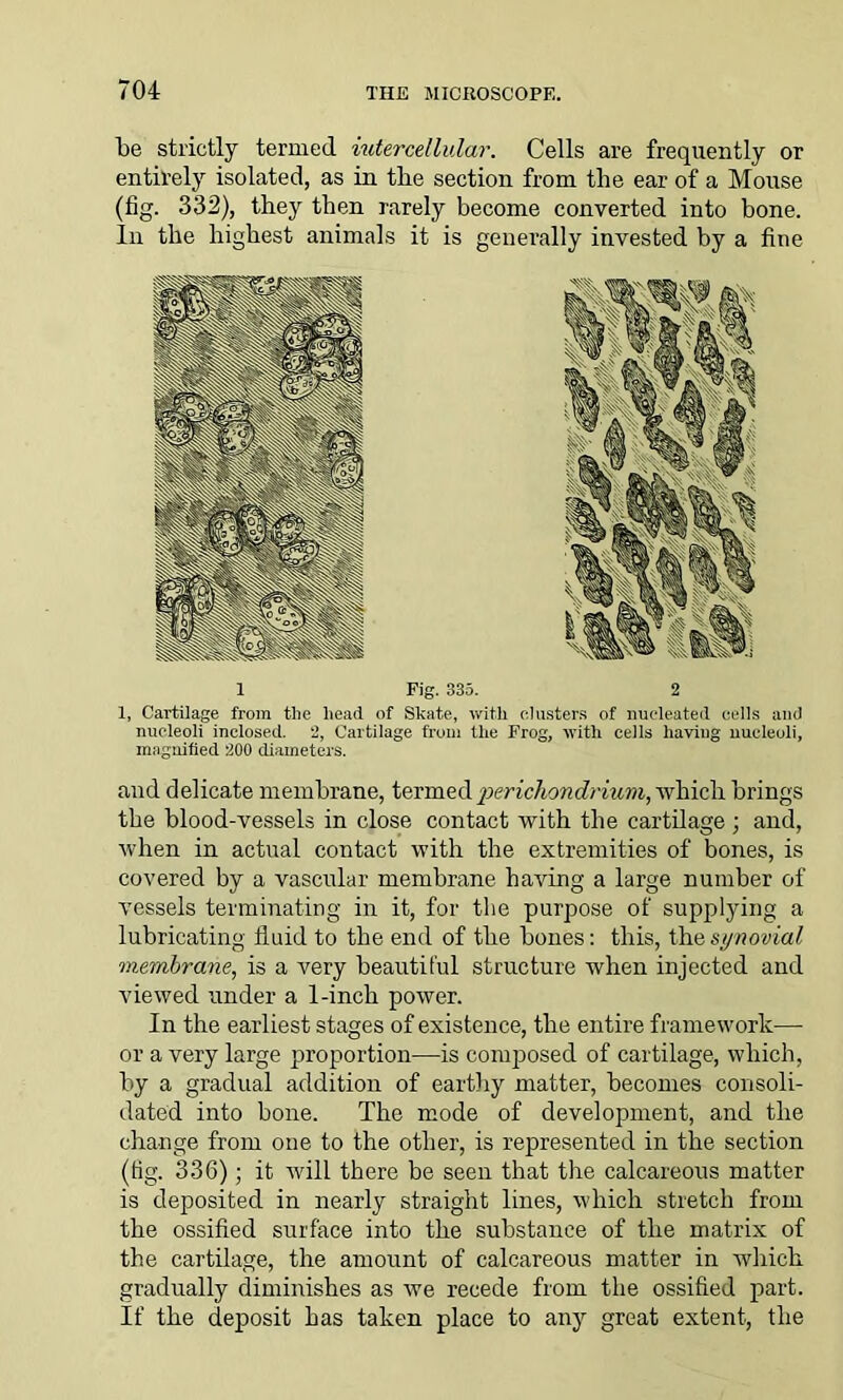 be strictly termed intercellular. Cells are frequently or entirely isolated, as in tbe section from the ear of a Mouse (fig. 332), they then rarely become converted into bone. In the highest animals it is generally invested by a fine 1 Fig. 335. 2 1, Cartilage from the head of Skate, with clusters of nucleated cells and nucleoli inclosed. 2, Cartilage from the Frog, with cells having nucleoli, magnified 200 diameters. and delicate membrane, termed perichondrium, which brings the blood-vessels in close contact with the cartilage; and, when in actual contact with the extremities of bones, is covered by a vascular membrane having a large number of vessels terminating in it, for the purpose of supplying a lubricating fiuid to the end of the bones: this, the synovial membrane, is a very beautiful structure when injected and viewed under a 1-inch power. In the earliest stages of existence, the entire framework— or a very large proportion—is composed of cartilage, which, by a gradual addition of earthy matter, becomes consoli- dated into bone. The mode of development, and the change from one to the other, is represented in the section (fig. 336); it will there be seen that the calcareous matter is deposited in nearly straight lines, which stretch from the ossified surface into the substance of the matrix of the cartilage, the amount of calcareous matter in which gradually diminishes as we recede from the ossified part. If the deposit has taken place to any great extent, the
