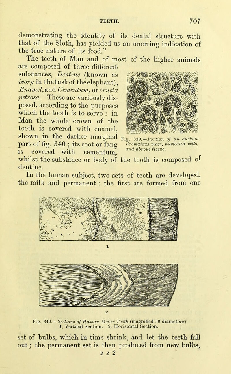 demonstrating the identity of its dental structure with that of the Sloth, has yielded us an unerring indication of the true nature of its food.” The teeth of Man and of most of the higher animals are composed of three different substances, Dentine (known as ivory in the tusk of the elephant), Enamel, and Cementum, or crusta petrosa. These are variously dis- posed, according to the purposes which the tooth is to serve : in Man the whole crown of the tooth is covered with enamel, shown in the darker marginal part of fig. 340 ; its root or fang is covered with cementum, whilst the substance or body of the tooth is composed of dentine. In the human subject, two sets of teeth are developed, the milk and permanent : the first are formed from one Fig. 339.— Portion of an c.nchon- dromatous mass, nucleated cells, and fibrous tissue. l 2 Fig. 340.—Sections of Human Molar Tooth (magnified 50 diameters). 1, Vertical Section. 2, Horizontal Section. set of bulbs, which in time shrink, and let the teeth fall out; the permanent set is then produced from new bulbs, z z 2