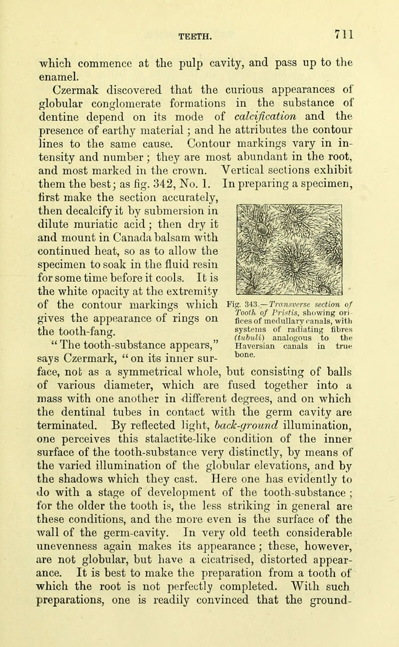which commence at the pulp cavity, and pass up to the enamel. Czermak discovered that the curious appearances ol globular conglomerate formations in the substance of dentine depend on its mode of calcification and the presence of earthy material; and he attributes the contour lines to the same cause. Contour markings vary in in- tensity and number ; they are most abundant in the root, and most marked in the crown. Vertical sections exhibit them the best; as fig. 342, No. 1. In preparing a specimen, first make the section accurately, then decalcify it by submersion in dilute muriatic acid; then dry it and mount in Canada balsam with continued heat, so as to allow the specimen to soak in the fluid resin for some time before it cools. It is the white opacity at the extremity of the contour markings which Fig- 343 gives the appearance of rings on the tooth-fang. “The tooth-substance appears,” says Czermark, “ on its inner sur- face, not as a symmetrical whole, but consisting of balls of various diameter, which are fused together into a mass with one another in different degrees, and on which the dentinal tubes in contact with the germ cavity are terminated. By reflected light, bade-ground illumination, one perceives this stalactite-like condition of the inner surface of the tooth-substance very distinctly, by means of the varied illumination of the globular elevations, and by the shadows which they cast. Here one has evidently to do with a stage of development of the tooth-substance ; for the older the tooth is, the less striking in general are these conditions, and the more even is the surface of the wall of the germ-cavity. In very old teeth considerable unevenness again makes its appearance; these, however, are not globular, but have a cicatrised, distorted appear- ance. It is best to make the preparation from a tooth of which the root is not perfectly completed. With such preparations, one is readily convinced that the ground- Transverse section of Tooth of Pristis, showing ori- fices of medullary canals, with systems of radiating fibres (tubuli) analogous to the Haversian canals in true bone.