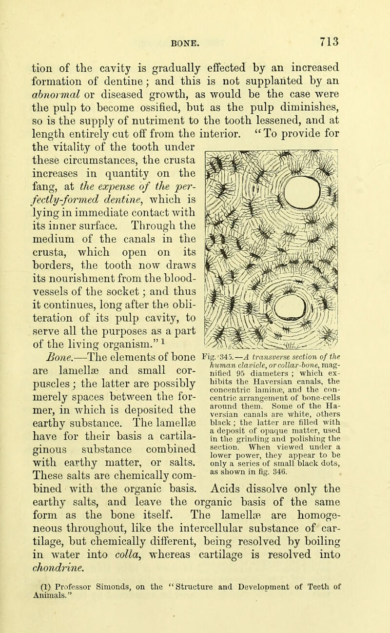 tion of the cavity is gradually effected by an increased formation of dentine; and this is not supplanted by an abnormal or diseased growth, as would be the case were the pulp to become ossified, but as the pulp diminishes, so is the supply of nutriment to the tooth lessened, and at length entirely cut off from the interior. “To provide for the vitality of the tooth under these circumstances, the crusta increases in quantity on the fang, at the expense of the per- fectly-formed dentine, which is lying in immediate contact with its inner surface. Through the medium of the canals in the crusta, which open on its borders, the tooth now draws its nourishment from the blood- vessels of the socket; and thus it continues, long after the obli- teration of its pulp cavity, to serve all the purposes as a part of the living organism.” 1 Bone.—The elements of bone are lamellae and small cor- puscles ; the latter are possibly merely spaces between the for- mer, in which is deposited the earthy substance. The lamellae have for their basis a cartila- ginous substance combined with earthy matter, or salts. These salts are chemically com- bined with the organic basis, earthy salts, and leave the organic basis of the same form as the bone itself. The lamellae are homoge- neous throughout, like the intercellular substance of car- tilage, but chemically different, being resolved by boiling in water into colla, whereas cartilage is resolved into chondrine. (1) Professor Simonds, on the “ Structure and Development of Teeth of Animals. ” Fig. *345.—A transverse section of the human cloMcle, or collar-hone, mag- nified 95 diameters ; which ex- hibits the Haversian canals, the concentric lamina, and the con- centric arrangement of bone-cells around them. Some of the Ha- versian canals are white, others black ; the latter are filled with a deposit of opaque matter, used in the grinding and polishing the section. When viewed under a lower power, they appear to be only a series of small black dots, as shown in fig. 346. Acids dissolve only the
