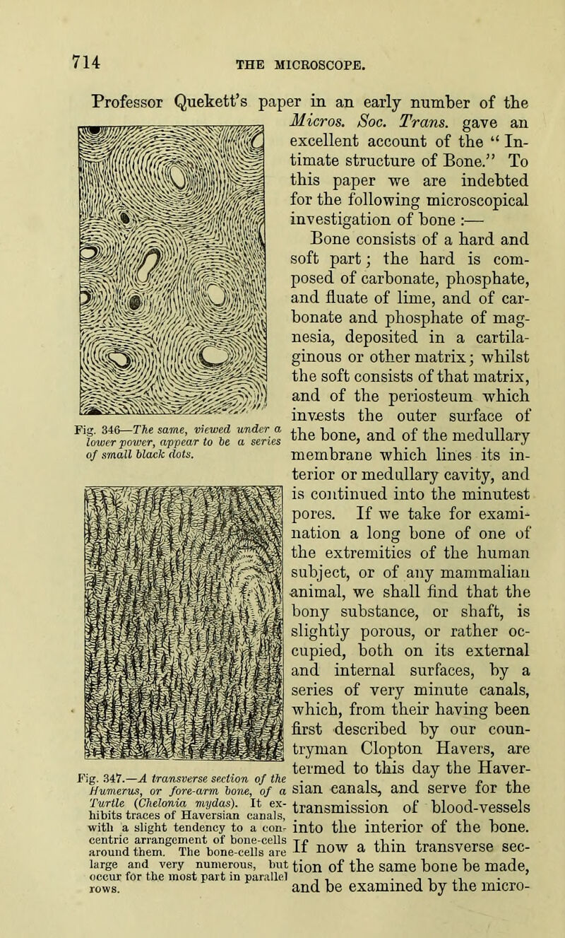 Fig. 346—The same, viewed under a lower power, appear to he a series of small black dots. Professor Quekett’s paper in an early number of the Micros. Soc. Trans, gave an excellent account of the “ In- timate structure of Bone.” To this paper we are indebted for the following microscopical investigation of bone :— Bone consists of a hard and soft part; the hard is com- posed of carbonate, phosphate, and fluate of lime, and of car- bonate and phosphate of mag- nesia, deposited in a cartila- ginous or other matrix; whilst the soft consists of that matrix, and of the periosteum which invests the outer surface of the bone, and of the medullary membrane which lines its in- terior or medullary cavity, and is continued into the minutest pores. If we take for exami- nation a long bone of one of the extremities of the human subject, or of any mammalian animal, we shall find that the bony substance, or shaft, is slightly porous, or rather oc- cupied, both on its external and internal surfaces, by a series of very minute canals, which, from their having been first described by our coun- tryman Clopton Havers, are termed to this day the Haver- Fig. 347.—A transverse section of the . , j ^ « ,, Humerus, or fore-arm hone, of a SlclH CclIlcilS, cUKl S6PV6 lor tiI6 HIlfsTan canals; transmission of blood-vessels with a slight tendency to a con. into the interior of the bone, centric arrangement of bone-ceUs Tf • |r„T1„v„rc;p around them. The bone-celis are now a tilin transt erse Sec large and very numerous, hut ti0n of the same bone be made, occur for the most part in parallel _ , -11.1 rows. and be examined by the micro-