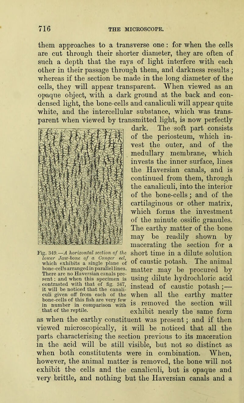 them approaches to a transverse one : for when the cells are cut through their shorter diameter, they are often of such a depth that the rays of light interfere with each other in their passage through them, and darkness results ; whereas if the section be made in the long diameter of the cells, they will appear transparent. When viewed as an opaque object, with a dark ground at the back and con- densed light, the bone-cells and canaliculi will appear quite white, and the intercellular substance, which was trans- parent when viewed by transmitted light, is now perfectly dark. The soft part consists of the periosteum, which in- vest the outer, and of the medullary membrane, which invests the inner surface, lines the Haversian canals, and is continued from them, through the canaliculi, into the interior of the bone-cells; and of the cartilaginous or other matrix, which forms the investment of the minute ossific granules. The earthy matter of the bone may be readily shown by macerating the section for a Fig. 349.— a horizontal section of the short time in a dilute solution lower Jaw-bone of a Conqer eel, n ■ • , t mi which exhibits a single plane of 01 caustic potash. Ihe animal bone-cells arranged™ parallel lines. matter may be procured by There are no Haversian canals pre- . ^ , 1 . sent; and when this specimen is USing dilute hydrochloric acid iMtod “f “ustic cuii given off from each of the when all the earthy matter bone-cells of this fish are very few • j , i , - ■,, in number in comparison with removed the section Will that of the reptile. exhibit nearly the same form as when the earthy constituent was present; and if then viewed microscopically, it will be noticed that all the parts characterising the section previous to its maceration in the acid will be still visible, but not so distinct as when botli constitutents were in combination. When, however, the animal matter is removed, the bone will not exhibit the cells and the canaliculi, but is opaque and very brittle, and nothing but the Haversian canals and a