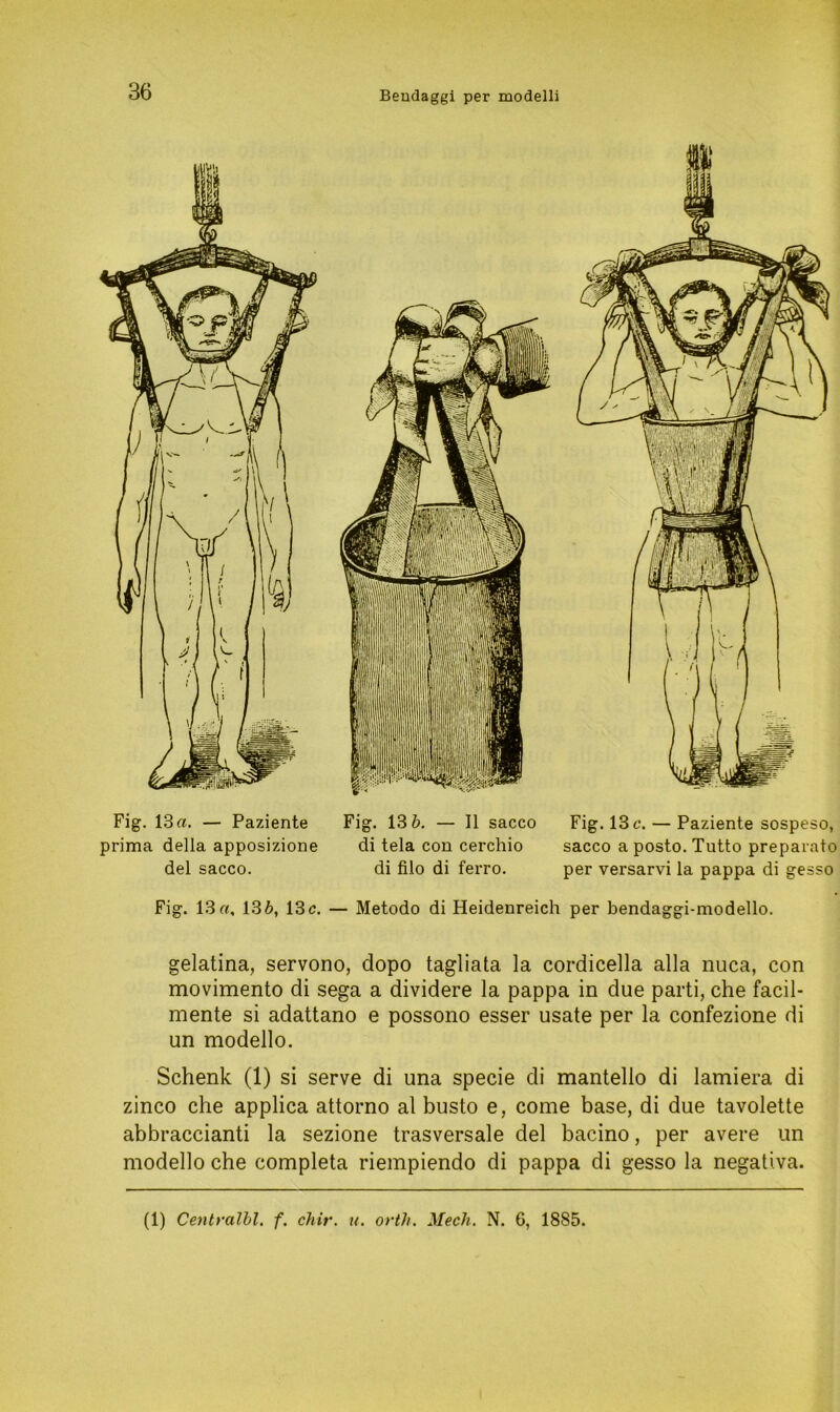 Fig. 13«. — Paziente Fig. 13 b. — II sacco Fig. 13 c. — Paziente sospeso, prima della apposizione di tela con cerchio sacco a posto. Tutto preparato del sacco. di filo di ferro. per versarvi la pappa di gesso Fig. 13«, 13b, 13c. — Metodo di Heidenreich per bendaggi-modello. gelatina, servono, dopo tagliata la cordicella alla nuca, con movimento di sega a dividere la pappa in due parti, che facil- mente si adattano e possono esser usate per la confezione di un modello. Schenk (1) si serve di una specie di mantello di lamiera di zinco che applica attorno al busto e, come base, di due tavolette abbraccianti la sezione trasversale del bacino, per avere un modello che completa riempiendo di pappa di gesso la negativa. (1) Centralbl. f. chir. u. orth. Meck. N. 6, 1885.