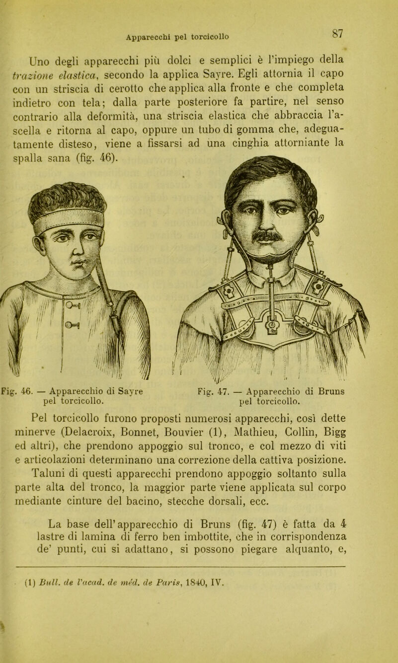 Uno degli apparecchi piü dolci e semplici e l’impiego della trazione elastica, secondo la applica Sayre. Egli attornia il capo con un striscia di cerotto che applica alla fronte e che completa indietro con tela; dalla parte posteriore fa partire, nel senso contrario alla deformitä, una striscia elastica che abbraccia l’a- scella e ritorna al capo, oppure un tubo di gomma che, adegua- tamente disteso, viene a fissarsi ad una cinghia attorniante la Pel torcicollo furono proposti numerosi apparecchi, cosi dette minerve (Delacroix, Bonnet, Bouvier (1), Mathieu, Collin, Bigg ed altri), che prendono appoggio sul tronco, e col mezzo di viti e articolazioni deterrninano una correzione della cattiva posizione. Taluni di questi apparecchi prendono appoggio soltanto sulla parte alta del tronco, la maggior parte viene applicata sul corpo mediante cinture del bacino, stecche dorsali, ecc. La base dell’apparecchio di Bruns (fig. 47) e fatta da 4 lastre di lamina di ferro ben imbottite, che in corrispondenza de’ punti, cui si adattano, si possono piegare alquanto, e, Fig. 46. — Apparecchio di Sayre pel torcicollo. Fig. 47. — Apparecchio di Bruns pel torcicollo. (1) Bull, de l'acad. de med. de Paris, 1840, IV.