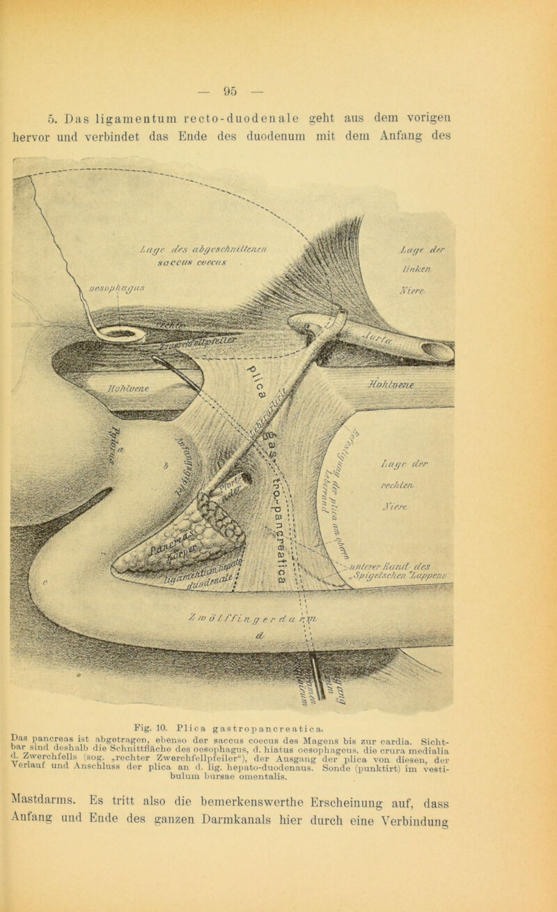 5. Das ligamentum recto-duodenale geht aus dem vorigen hervor und verbindet das Ende des duodenum mit dem Anfang des Lage des abgesc/iniitetun saccus cvecus Oesophagus JLo/Uvefie Hohlvene * -r-rr--. ' T Lage der linken Niere La (je der \\ • V ^ * \ > 7 ^ r* v -f -v V .r - 2 ^ re.diU.rb . 1 irre. - A ro u / f L‘i n g e /• d a ry \n ■ d Fig. 10. Plica gastropancreatica. Das pancreas ist abgetragen, ebenso der saccus coecus des Magens bis zur cardia. Sicht- bar sind deshalb die Schnittfläche des Oesophagus, d. hiatus oesophageus. die crura medialia cl. Zwerchfells (sog. „rechter Zwerchfellpfeiler“), der Ausgang der plica von diesen, der verlaut und Anschluss der plica an d. lig. hepato-duodenaus. Sonde (punktirt) im Vesti- bül um bursae omentalis. Mastdarms. Es tritt also die bemerkenswerthe Erscheinung auf, dass Anfang und Ende des ganzen Darmkanals hier durch eine Verbindung