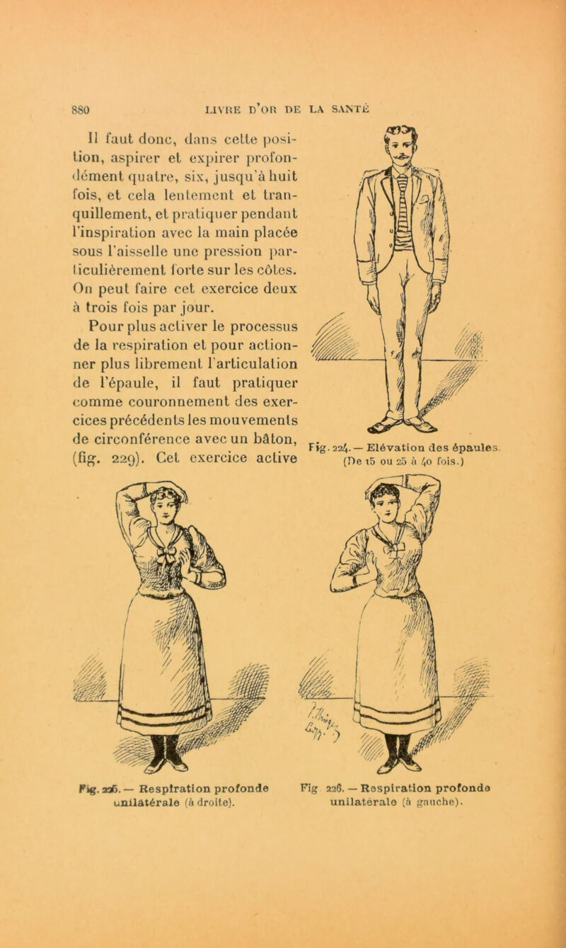 Fig. aaß. — Respiration profonde unilaterale (ä droite). Fig 226. — Respiration profonde unilaterale (ä gnuche). II laut donc, clans cette Posi- tion, aspirer et expirer proion- dement quatre, six, jusqu’ähuit fois, et cela lentement et tran- quillement, et pratiquer pendant tinspiration avec la main placee sous l’aisselle une pression par- liculiörement forte sur les cötcs. On peut faire cet exercice deux a trois fois par jour. Pour plus acliver le processus de la respiration et pour action- ner plus librement l’articulalion de l’iüpaule, il laut pratiquer eomme couronnement des exer- cices precödcnts les mouvemenls de circonference avec un bäton, (fig-. 229). Cet exercice aclive Fig. 224.— E16vation des epaules. (Re t5 ou 25 ä 4o fois.)