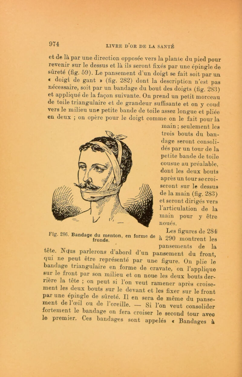 et de lä par une direction opposee vers la plante du pied pour revenir siir le dessus et lä ils seront fixes par une epingle de sürete (fig. 59). Le panseinent d’un doigt se fait seit par un « doigt^ de gant » (fig. 282) dont la descripticui n’est pas necessaire, seit par un bandage du bout des doigts (fig. 283) et applique de la fagon suivante. On prend un petit morceau de teile triangulaire et de grandeur süffisante et on y coud vers le milieu une petite bande de teile assez longue et pliee en deux ; on opere pour le doigt comme on le fait pour la lucuu; seuiement les trois bouts du ban- dage seront consoli- des par un tour de la petite bande de teile cousue au prealable, dont les deux bouts apres un tour se croi- seront sur le dessus de la main (fig. 283) et seront diriges vers Tarticulation de la main pour y etre neues. Vier ^ figures de 284 tig. 286. Bandage du menton, en forme de ' oqa , , i fronde. ^ montrent les _ ■ panseinents de la tete. JNctus parlerons d’abord d’un pansement du front, qui ne peut etre represente par une figure. On plie Ic banctage triangulaire en forme de cravate, on l’applique eur le front par son milieu et on noue les deux bouts der- riere la tete ; on peut si Fon reut raniener apres croise- ment les deux bouts sur le devant et les fixer sur le front par une epingle de sürete. II en sera de meme du panse- ment de lmil ou de Foreille. _ Si Fon reut eonsolider fortement le bandage on fera croiser le second tour aveo le Premier. Ces bandages sont appeles . Bandages ä
