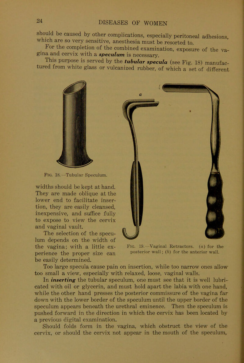 should be caused by other complications, especially peritoneal adhesions which are so very sensitive, anesthesia must be resorted to. For the completion of the combined examination, exposure of the Va- gina and cervix with a speculum is necessary. This purpose is served by the tubulär specula (see Fig. 18) manufac- tured from white glass or vulcanized rubber, of which a set of different Fig. 18.—Tubulär Speculum. I a Fig. 19.—Vaginal Retractors. (a) for the posterior wall; (b) for the anterior wall. widths should be kept at hand. They are made oblique at the lower end to facilitate inser- tion, they are easily cleansed, inexpensive, and suffice fully to expose to view the cervix and vaginal vault. The selection of the specu- lum depends on the width of the vagina; with a little ex- perience the proper size can be easily determined. Too large specula cause pain on insertion, while too narrow ones allow too small a view, especially with relaxed, loose, vaginal walls. In inserting the tubulär speculum, one must see that it is well lubri- cated with oil or glycerin, and must hold apart the labia with one hand, while the other hand presses the posterior commissure of the vagina far down with the lower border of the speculum until the upper border of the speculum appears beneath the urethral eminence. Then the speculum is pushed forward in the direction in which the cervix has been located by a previous digital examination. Should folds form in the vagina, which obstruct the view of the cervix, or should the cervix not appear in the mouth of the speculum,