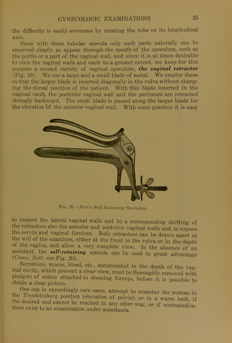 the difficulty is easily overcome by rotating the tube on its longitudinal axis. Since with these tubulär specula only such parts naturally can be observed clearly as appear through the mouth of the speculum, such as the portio or a part of the vaginal wall, and since it is at times desirable to view the vaginal walls and vault to a greater extent, we keep for this purpose a second variety of vaginal speculum, the vaginal retractor (Fig. 19). We use a large and a small blade of metal. We employ these so that the langer blade is inserted diagonally in the vulva without chang- ing the dorsal position of the patient. With this blade inserted in the vaginal vault, the posterior vaginal wall and the perineum are retracted strongly backward. The small blade is passed along the larger blade for the elevation of the anterior vaginal wall. With some practice it is easy to inspect the lateral vaginal walls and by a corresponding shifting of the retractors also the anterior and posterior vaginal walls and to expose the cervix and vaginal fornices. Both retractors can be drawn apart at the will of the examiner, either at the front in the vulva or in the depth of the vagina, and allow a very complete view. In the absence of an assistant the self-retaining specula can be used to great advantage (Cusco, Nott: see Fig. 20). Secretions, mucus, blood, etc., accumulated in the cWh nf Fig. 20.—Nott’s Self-Retaming- Speculum.