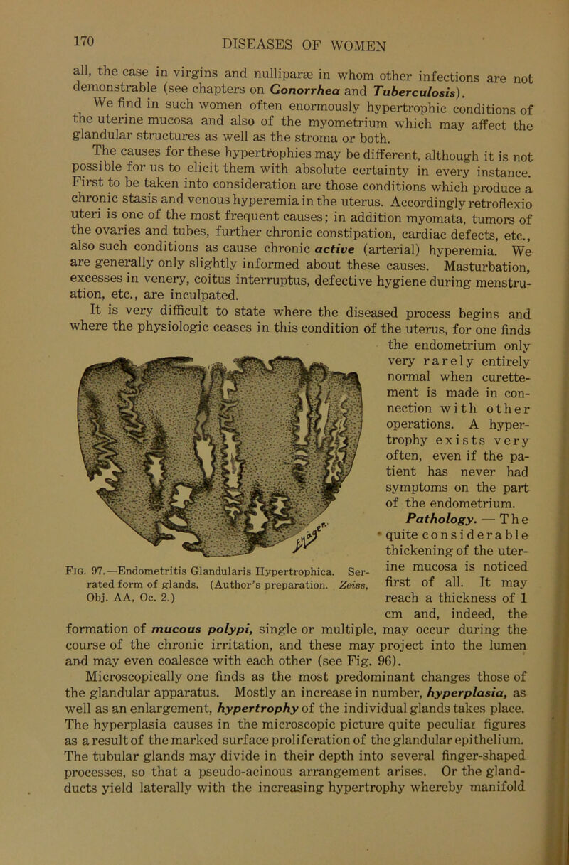 all, the case in virgins and nulliparae in whom other infections are not demonstrable (see chapters on Gonorrhea and Tuberculosis). We find in such women often enormously hypertrophic conditions of the uterine mucosa and also of the myometrium which may affect the glandular structures as well as the stroma or both. The causes for these hypertrophies may be different, although it is not possible foi us to elicit them with absolute certainty in every instance. First to be taken into consideration are those conditions which produce a chronic stasis and venous hyperemia in the uterus. Accordingly retroflexio Uteri is one of the most frequent causes; in addition myomata, tumors of the ovaries and tubes, further chronic constipation, cardiac defects, etc., also such conditions as cause chronic active (arterial) hyperemia. We are generally only slightly informed about these causes. Masturbation, excesses in venery, coitus interruptus, defective hygiene during menstru- ation, etc., are inculpated. It is very difficult to state where the diseased process begins and where the Physiologie ceases in this condition of the uterus, for one finds the endometrium only very r a r e 1 y entirely normal when curette- ment is made in Con- nection with other operations. A hyper- trophy exists very often, even if the pa- tient has never had Symptoms on the part of the endometrium. Pathology. — The • quite considerable thickening of the uter- Fig. 97.—Endometritis Glandularis Hypertrophica. Ser- *ne rnucosa is noticecL rated form of glands. (Author’s preparation. Zeiss, first of all. It may Obj. AA, Oc. 2.) reach a thickness of 1 cm and, indeed, the formation of mucous polypi, single or multiple, may occur during the course of the chronic irritation, and these may project into the lumen and may even coalesce with each other (see Fig. 96). Microscopically one finds as the most predominant changes those of the glandular apparatus. Mostly an increase in number, hyperplasia, as well as an enlargement, hypertrophy of the individual glands takes place. The hyperplasia causes in the microscopic picture quite peculiar figures as aresult of themarked surface proliferation of the glandular epithelium. The tubulär glands may divide in their depth into several finger-shaped processes, so that a pseudo-acinous arrangement arises. Or the gland- ducts yield laterally with the increasing hypertrophy whereby manifold