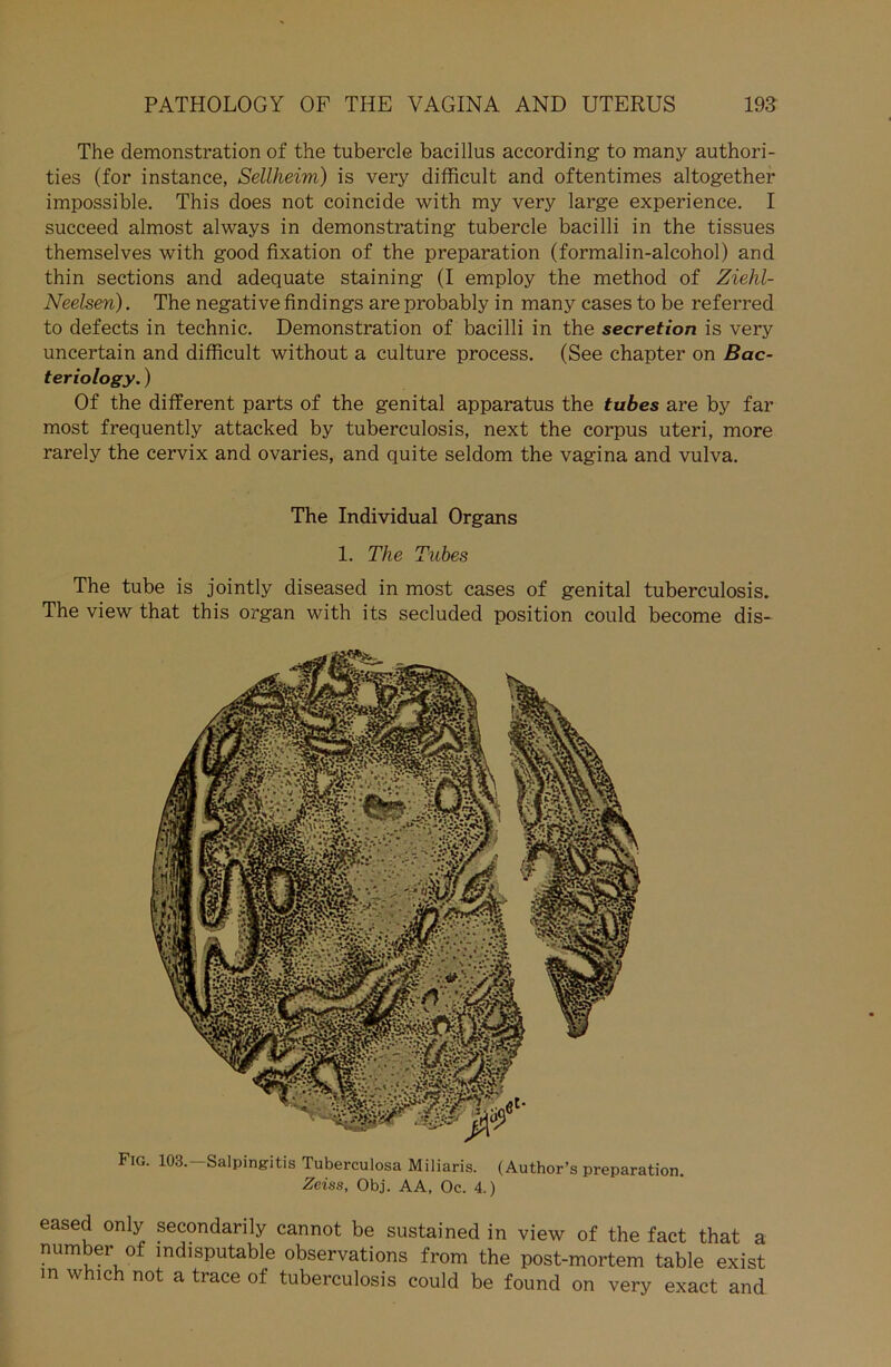 The demonstration of the tubercle bacillus according to many authori- ties (for instance, Seilheim) is very difficult and oftentimes altogether impossible. This does not coincide with my very large experience. I succeed almost always in demonstrating tubercle bacilli in the tissues themselves with good fixation of the preparation (formalin-alcohol) and thin sections and adequate staining (I employ the method of Ziehl- Neelsen). The negative Undings are probably in many cases to be referred to defects in technic. Demonstration of bacilli in the secretion is very uncertain and difficult without a culture process. (See chapter on Bac- teriology.) Of the different parts of the genital apparatus the tubes are by far most frequently attacked by tuberculosis, next the corpus uteri, more rarely the cervix and ovaries, and quite seldom the vagina and vulva. The Individual Organs 1. The Tubes The tube is jointly diseased in most cases of genital tuberculosis. The view that this organ with its secluded Position could become dis- Fig. 103. Salpingitis Tuberculosa Miliaris. (Author’s preparation. Zeins, Obj. AA, Oc. 4.) eased only secondarily cannot be sustained in view of the fact that a number of indisputable observations from the post-mortem table exist m which not a trace of tuberculosis could be found on very exact and