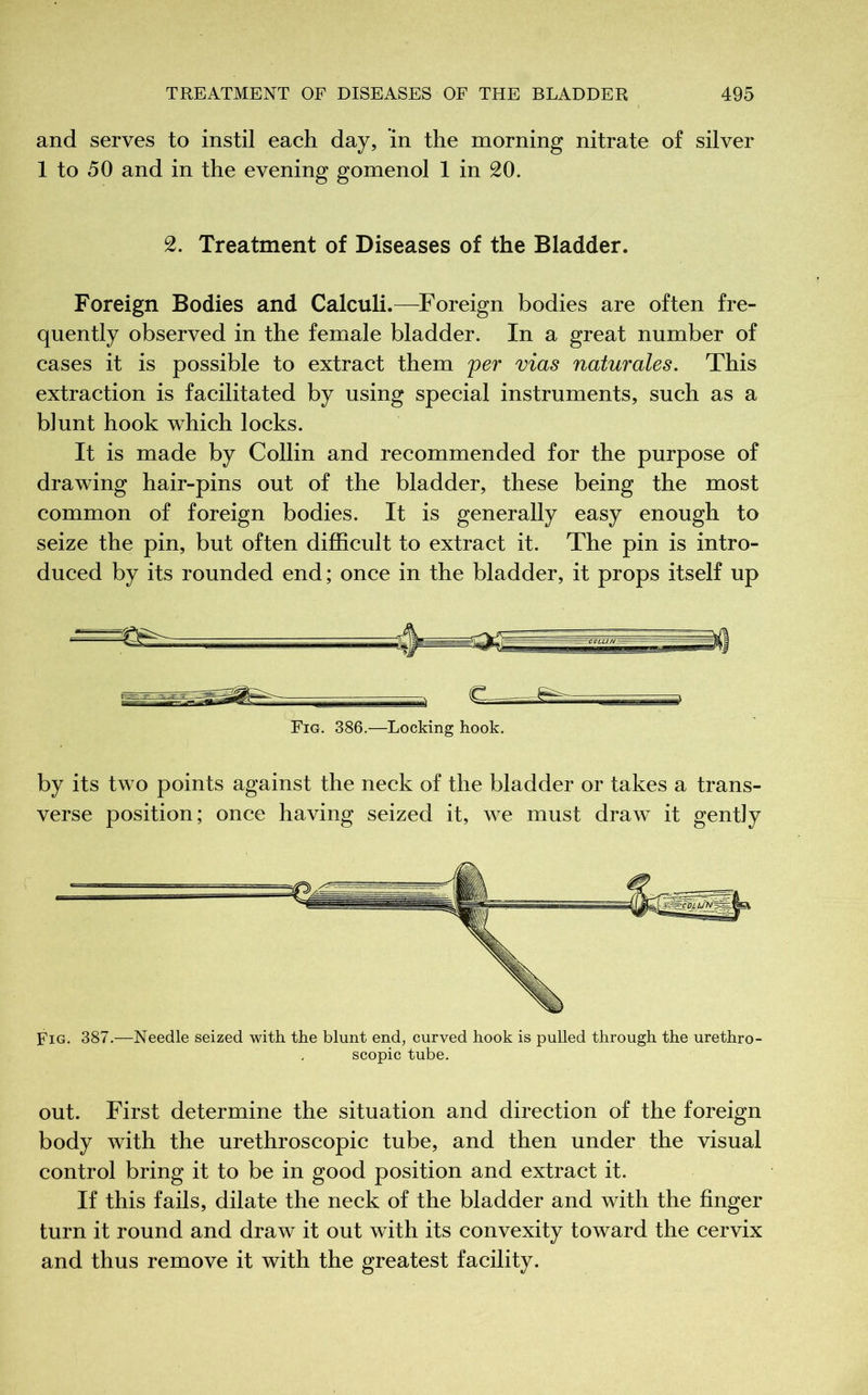and serves to instil each day, in the morning nitrate of silver 1 to 50 and in the evening gomenol 1 in 20. 2. Treatment of Diseases of the Bladder. Foreign Bodies and Calculi.—Foreign bodies are often fre- quently observed in the female bladder. In a great number of cases it is possible to extract them per vias naturales. This extraction is facilitated by using special instruments, such as a blunt hook which locks. It is made by Collin and recommended for the purpose of drawing hair-pins out of the bladder, these being the most common of foreign bodies. It is generally easy enough to seize the pin, but often difficult to extract it. The pin is intro- duced by its rounded end; once in the bladder, it props itself up Fig. 386.—Locking hook. by its two points against the neck of the bladder or takes a trans- verse position; once having seized it, we must draw it gently Fig. 387.—Needle seized with the blunt end, curved hook is pulled through the urethro- scopic tube. out. First determine the situation and direction of the foreign body with the urethroscopic tube, and then under the visual control bring it to be in good position and extract it. If this fails, dilate the neck of the bladder and with the finger turn it round and draw it out with its convexity toward the cervix and thus remove it with the greatest facility.