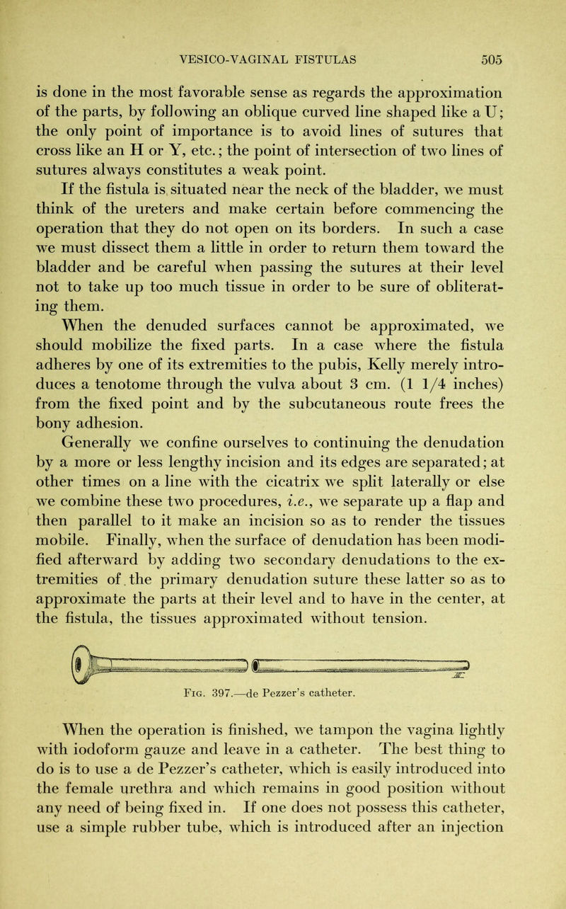 is done in the most favorable sense as regards the approximation of the parts, by following an oblique curved line shaped like aU; the only point of importance is to avoid lines of sutures that cross like an H or Y, etc. ; the point of intersection of two lines of sutures always constitutes a weak point. If the fistula is situated near the neck of the bladder, we must think of the ureters and make certain before commencing the operation that they do not open on its borders. In such a case we must dissect them a little in order to return them toward the bladder and be careful when passing the sutures at their level not to take up too much tissue in order to be sure of obliterat- ing them. When the denuded surfaces cannot be approximated, we should mobilize the fixed parts. In a case where the fistula adheres by one of its extremities to the pubis, Kelly merely intro- duces a tenotome through the vulva about 3 cm. (1 1/4 inches) from the fixed point and by the subcutaneous route frees the bony adhesion. Generally we confine ourselves to continuing the denudation by a more or less lengthy incision and its edges are separated ; at other times on a line with the cicatrix we split laterally or else we combine these two procedures, i.e., we separate up a flap and then parallel to it make an incision so as to render the tissues mobile. Finally, when the surface of denudation has been modi- fied afterward by adding two secondary denudations to the ex- tremities of the primary denudation suture these latter so as to approximate the parts at their level and to have in the center, at the fistula, the tissues approximated without tension. Fig. 397.-—de Pezzer’s catheter. When the operation is finished, we tampon the vagina lightly with iodoform gauze and leave in a catheter. The best thing to do is to use a de Pezzer’s catheter, which is easily introduced into the female urethra and which remains in good position without any need of being fixed in. If one does not possess this catheter, use a simple rubber tube, which is introduced after an injection