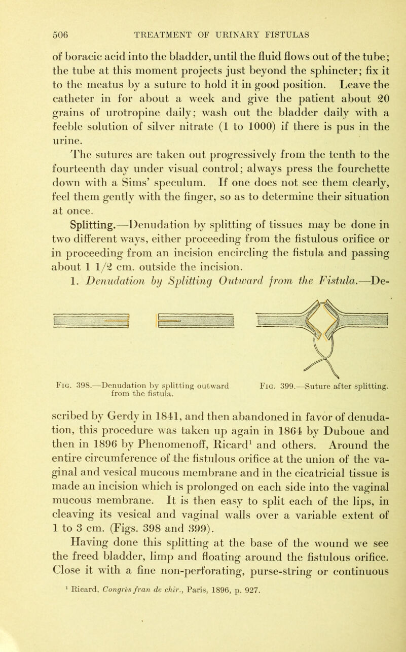of boracic acid into tlie bladder, until the fluid flows out of the tube ; the tube at this moment projects just beyond the sphincter; fix it to the meatus by a suture to hold it in good position. Leave the catheter in for about a week and give the patient about 20 grains of urotropine daily; wash out the bladder daily with a feeble solution of silver nitrate (1 to 1000) if there is pus in the urine. The sutures are taken out progressively from the tenth to the fourteenth day under visual control; always press the fourchette down with a Sims’ speculum. If one does not see them clearly, feel them gently with the finger, so as to determine their situation at once. Splitting.—Denudation by splitting of tissues may be done in two different ways, either proceeding from the fistulous orifice or in proceeding from an incision encircling the fistula and passing about 11/2 cm. outside the incision. 1. Denudation by Splitting Outward from the Fistula.-—De- scribed by Gerdy in 1841, and then abandoned in favor of denuda- tion, this procedure was taken up again in 1864 by Duboue and then in 1896 by Phenomenoff, Ricard1 and others. Around the entire circumference of the fistulous orifice at the union of the va- ginal and vesical mucous membrane and in the cicatricial tissue is made an incision which is prolonged on each side into the vaginal mucous membrane. It is then easy to split each of the lips, in cleaving its vesical and vaginal walls over a variable extent of 1 to 3 cm. (Figs. 398 and 399). Having done this splitting at the base of the wound we see the freed bladder, limp and floating around the fistulous orifice. Close it with a fine non-perforating, purse-string or continuous 1 Ricard, Congrès fran de chir., Paris, 1896, p. 927.