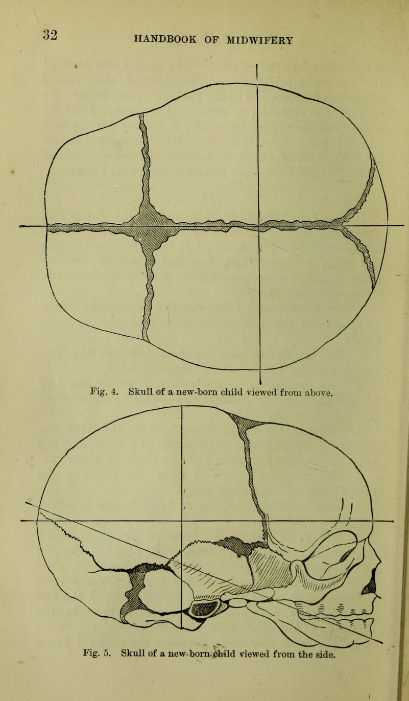 Fig. 4. Skull of a new-born child viewed from above.