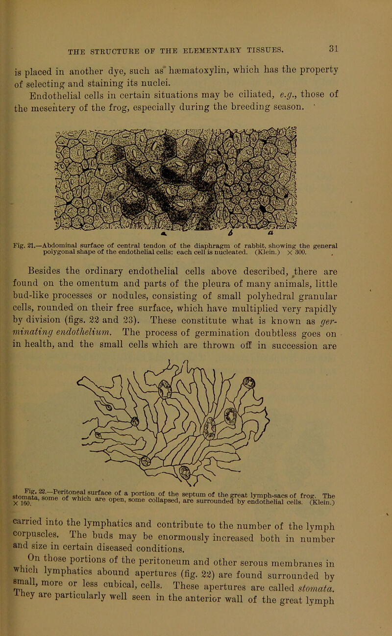 is placed in another dye, such as haematoxylin, which has the property of selecting and staining its nuclei. Endothelial cells in certain situations may be ciliated, e.g., those of the mesentery of the frog, especially during the breeding season. ■ Fig. 21.—Abdominal surface of central tendon of the diaphragm of rabbit, showing the general polygonal shape of the endothelial cells: each cell is nucleated. (Klein.) x 300. Besides the. ordinary endothelial cells above described, there are found on the omentum and parts of the pleura of many animals, little bud-like processes or nodules, consisting of small polyhedral granular cells, rounded on their free surface, which have multiplied very rapidly by division (figs. 22 and 23). These constitute what is known as ger- minating endothelium. The process of germination doubtless goes on in health, and the small cells which are thrown off in succession are carried into the lymphatics and contribute to the number of the lymph corpuscles. The buds may be enormously increased both in number and size in certain diseased conditions. On those portions of the peritoneum and other serous membranes in which lymphatics abound apertures (fig. 22) are found surrounded by srru , more or less cubical, cells. These apertures are called stomata. hey are particularly well seen in the anterior wall of the great lymph