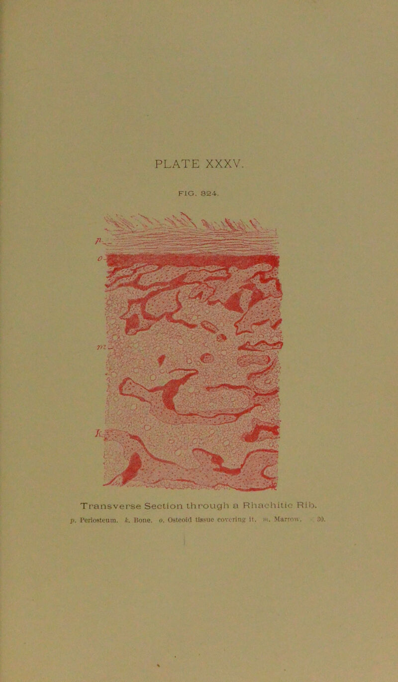 PLATE XXXV p. Periostturn. k. Kone. o. Osteoid tls.sue covering it •Hi. Marron