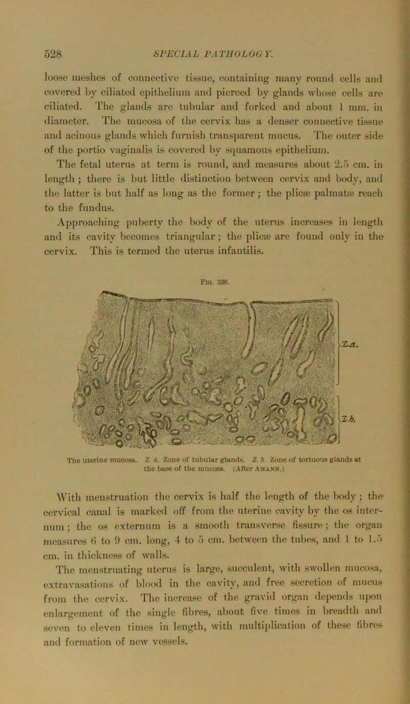 loose meshes of conuective tissuc, containing mauy round cells and covered by ciliated epitheliiun and pierced by glands whose cells are ciliated. The glands are tnbnlar and forked and abont 1 mm. in diameter. The mucosa of the cervix has a denser conuective tissne and acinons glands which fnrnish transparent mncns. The onter side of the portio vaginalis is cov<!red by sqnamous epithelium. The fetal nterns at tcrm is round, and measures abont 2.5 cm. in length ; there is bnt little distinction between cervix and body, and tlie latter is bnt half as long as the former; the plicae palmatu) reach to the fnndus. Approaching pnberty the body of the nterns increases in length and its cavity becomes triangulär; the plicie are fonnd only in the cervix. This is termcd the nterns infantilis. Fig. 336. The uterine mucosa. Z. a. Zone of tubulär glands. Z. b. Zone of tortuous glands at the base of the mucosa. (After Amann.) With menstrnation the cervix is half the length of the body; the cervical canal is marked off frorn the uterine cavity by the os inter- nnm; the os externnm is a smooth transverse fissnre; the organ measures (5 to 9 cm. long, 4 to 5 cm. between the tnbes, and 1 to 1.5 cm. in thickness of walks. The men.strnating nterns is large, snccnlent, with swollen mucosa, extravasations of blood in the cavity, and free secretion of mncns from the cervix. The increase of the gravid organ depends npon enlargement of the single tibres, abont five times in breadth and .seven to cleven times in length, with multiplication of these tibres and formation of new vessels.