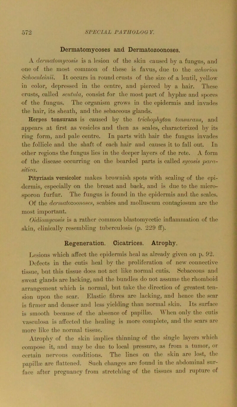 Dermatomycoses and Dermatozoonoses. A dcnnatomycosi/i is a lesion of tho skiu caused hy a fuiigus, and oue of the niost common of these is favus, due to the achorion Schncnleinii It occurs in round ernste of tlie size of a Icntil, yellow in color, depressed in the centre, and pierced by a hair. These ernsts, called scutula, consist for the most part of hypha3 and spores of the fungus. The organism grows in the epidermis and invades tlie hair, ite sheath, and the sebaceous glauds. Herpes tonsurans is caused by the trichophyton tonnumns, and appears at first as vesicles and then as scales, characterized by ite ring form, and pale centre. In parts with hair the fungus invades the follicle and the shaft of each hair and causes it to fall out. In other regions the fungus lies in the deeper layers of the rete. A form of the disease occurring on the bearded parts is called sycosis para- siticu. Pityriasis versicolor makes brownish spots with scaling of the epi- dermis, especially on the breast and back, and is due to the micro- sporon furfur. The fungus is found in the epidermis and the scales. Of the dermatozoonosex, scabies and molluscum contagiosum are the most important. Oidiomycosbi is a rather common blastomycetic inflammation of the skiu, clinically resembling tuberculosis (p. 229 ff). Regeneration. Cicatrices. Atrophy. Lesions which affect the epidermis heal as already given on p. 92. Defects in the cutis heal by the proliferation of neAv connective tissue, but this tissue does not act like normal cutis. Sebaceous and sweat glauds are lacking, and the bundles do not assume the rhomboid arrangeineut which is normal, but take the direction of greatest ten- sion upon the scar. Elastic fibres are lacking, and hence the scar is firmer and denser and less yielding than normal skiu. Its surface is smooth because of tlie absence of papillre. hen only the cutis vasculosa is affected the hcaling is more complete, and the scai*s are more like the normal tissue. Atrophy of the skiu implies thinning of the single layers which compose it, and may be due to local pressure, as from a tumor, or certain nervous conditions. The lines on the skin are lost, the jiapilhe are fiattened. Such changes are found in the abdominal sur- face after preguancy from Stretching of the tissues and rupture of