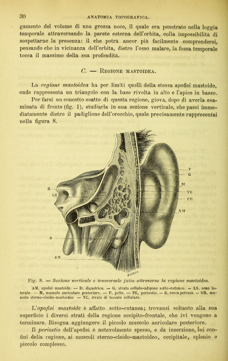 80 gamento del volume di una grossa noce, il quale era penetrato nella loggia temporale attraversando la parete esterna deH’orbita, colla impossibilità di sospettarne la presenza: il che potrà ancor più facilmente comprendersi, pensando che in vicinanza dell’orbita, dietro l’osso malare, la fossa temporale tocca il massimo della sua profondità. C. — Regione mastoidea. La regione mastoidea ha per limiti quelli della stessa apofisi mastoide, onde rappresenta un triangolo con la base rivolta in alto e l’apice in basso. Per farsi un concetto esatto di questa regione, giova, dopo di averla esa- minata di fronte (fìg. 1), studiarla in una sezione verticale, che passi imme- diatamente dietro il padiglione dell’orecchio, quale precisamente rappresentai nella figura 8. Fig. 8. — Sezione verticale e trasversale fatta attraverso la regione mastoidea. AM, apofisi masloide. — D, di);astrico. — G, strato cellulo*adiposo sotto-cutanfio. — LS, seno la- terale’ — M, muscolo auricolare posteriore. — P, pelle. — PE, periostio. — K, rocca petrosa. — SM, mu- scolo sterno-cleido-mastoideo — TC, strato di tessuto cellulare. Uapofisi mastoide è affatto sotto-cutanea; trovansi soltanto alla sua superficie i diversi strati della regione occipite-frontale, che ivi vengono a terminare. Bisogna aggiungere il piccolo muscolo auricolare posteriore. Il periostio delhapofisi è notevolmente spesso, e dà inserzione, sui con- fini della legione, ai muscoli sterno-cleido-mastoideo, occipitale, splenio e piccolo complesso.