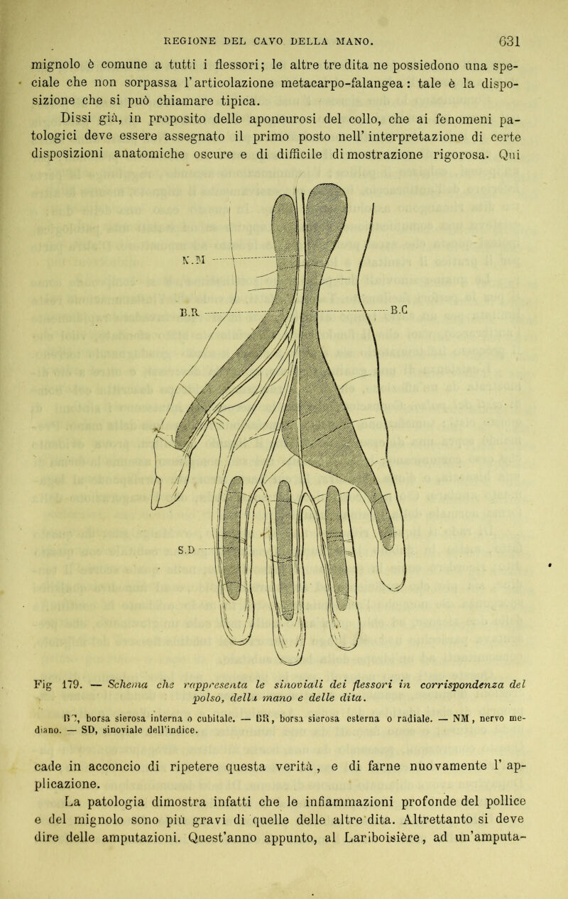 mignolo ò comune a tutti i flessori; le altre tre dita ne possiedono una spe- ciale che non sorpassa Ï articolazione metacarpo-falangea : tale è la dispo- sizione che si può chiamare tipica. Dissi già, in proposito delle aponeurosi del collo, che ai fenomeni pa- tologici deve essere assegnato il primo posto nell’ interpretazione di certe disposizioni anatomiche oscure e di difficile dimostrazione rigorosa. Qui Fig 179. — Schema che rappresenta le sinoviali dei flessori in corrispondenza del polso, dellx mano e delle dita. B7, borsa sierosa interna o cubitale. — tJR, borsa sierosa esterna o radiale. — NM , nervo me- diano. — SD, sinoviale dell’indice. cade in acconcio di ripetere questa verità, e di farne nuovamente l’ap- plicazione. La patologia dimostra infatti che le infiammazioni profonde del pollice e del mignolo sono più gravi di quelle delle altre'dita. Altrettanto si deve dire delle amputazioni. Quest’anno appunto, al Lariboisière, ad un’amputa-