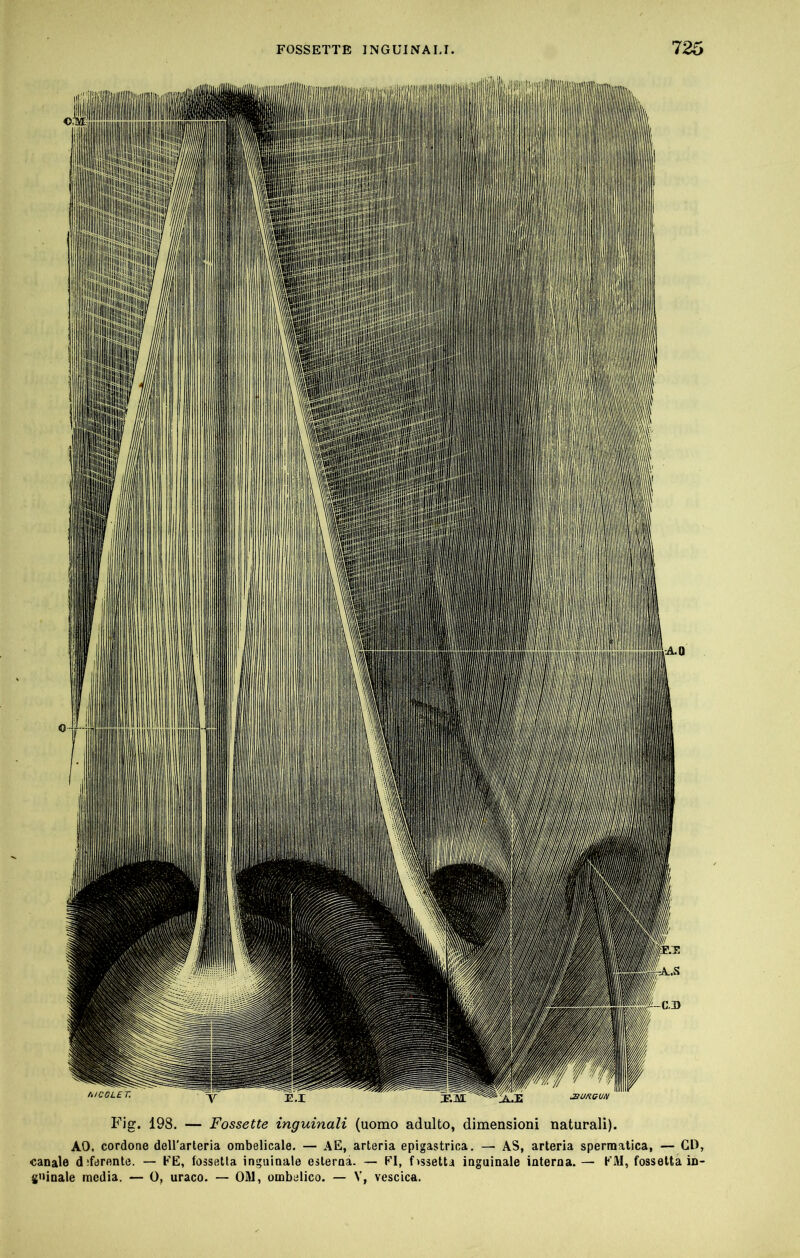 Fig. 198. — Fossette inguinali (uomo adulto, dimensioni naturali). AO. cordone dell'arteria ombelicale. — A E, arteria epigastrica. — AS, arteria spermatica, — CO, canale d;ferente. — EE, fossetta inguinale esterna. — FI, f>ssetta inguinale interna. — KM, fossetta in- gninale media. — 0, uraco. — OM, ombelico. — V, vescica.