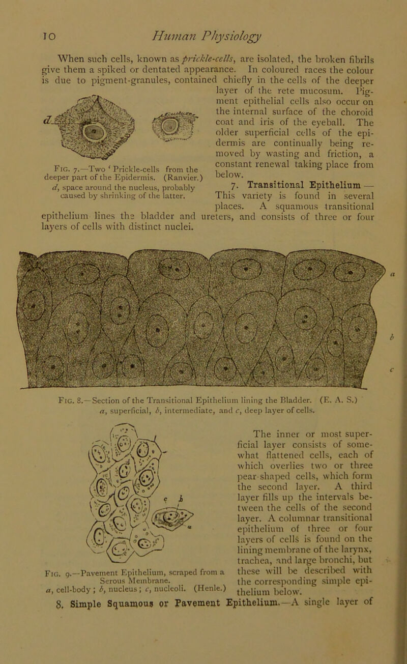 When such cells, known as prickle-cells, are isolated, the broken fibrils give them a spiked or dentated appearance. In coloured races the colour is due to pigment-granules, contained chiefly in the cells of the deeper layer of the rete mucosum. Pig- ment epithelial cells also occur on the internal surface of the choroid coat and iris of the eyeball. The older superficial cells of the epi- dermis are continually being re- moved by wasting and friction, a constant renewal taking place from below. 7. Transitional Epithelium — This variety is found in several places. A squamous transitional bladder and ureters, and consists of three or four Fig. 7.—Two ‘ Prickle-cells from the deeper part of the Epidermis. (Ranvier.) d, space around the nucleus, probably caused by shrinking of the latter. epithelium lines th layers of cells with distinct nuclei Fig. 8.— Section of the Transitional Epithelium lining the Bladder. (E. A. S.) a, superficial, b, intermediate, and c, deep layer of cells. Fig. 9.—Pavement Epithelium, scraped from a Serous Membrane. «, cell-body ; b, nucleus ; c, nucleoli. (Henle. 8, Simple Squamous or Pavement The inner or most super- ficial layer consists of some- what flattened cells, each of which overlies two or three pear shaped cells, which form the second layer. A third layer fills up the intervals be- tween the cells of the second layer. A columnar transitional epithelium of three or four layers of cells is found on the lining membrane of the larynx, trachea, and large bronchi, but 1 these will be described with the corresponding simple epi- ' thelium below. Epithelium.—A single layer of