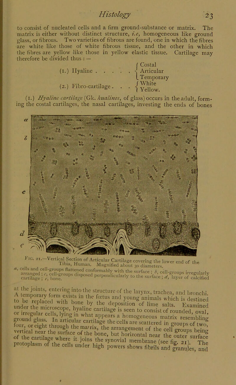 to consist of nucleated cells and a firm ground-substance or matrix. The matrix is either without distinct structure, i.e, homogeneous like ground glass, or fibrous. Two varieties of fibrous are found, one in which the fibres are white like those of white fibrous tissue, and the other in which the fibres are yellow like those in yellow elastic tissue. Cartilage may therefore be divided thus : — ( Costal (i.) Hyaline *j Articular L Temporary (2.) Fibro-cartilage. . . {y^low. (i.) Hyaline cartilage (Gk. hualinos, of glass) occurs in the adult, form- ing the costal cartilages, the nasal cartilages, investing the ends of bones 1 ig. 21. Vertical Section of Articular Cartilage covering the lower end of the Tibia, Human. Magnified about 30 diameters. <1, cells and cell-groups flattened conformably with the surface • b cell-vronns 1 , cartilage j at the joints, entering into the structure of the larynx, trachea, and bronchi - temporary form exists in the foetus and young animals which is destined to be replaced with bone by the deposition of lime salts Exam ned or bTemiLrcensT^’ kyah,ne Cartila&e is seen to consist of rounded, oval or irregular cells, lying m what appears a homogeneous matrix resernblimr ground glass. In articular cartilage the cells are scatteredTe^MSlw? four, or eight through themairix, the arrangement of the celfrrrouns beimr vertica1 near the surface of the bone, but horizontal near the outer surfirp of the cartilage where it joins the synovial membrane (see fi2 2 ) ti protoplasm of the cells under high powers shows fibrils and franules, [id