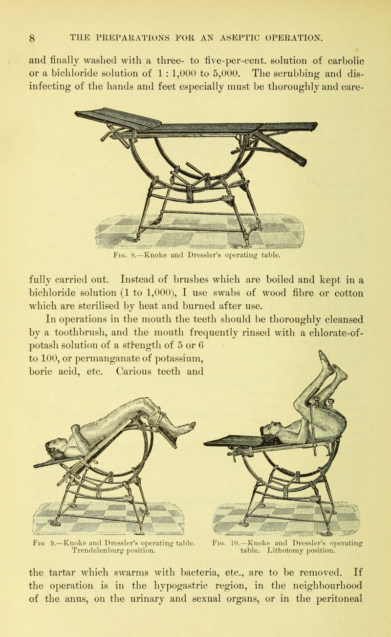 and finally washed with a three- to five-per-cent, solution of carbolic or a bichloride solution of 1 : 1,000 to 5,000. The scrubbing and dis- infecting of the hands and feet especially must be thoroughly and care- Fig. 8.—Knoke and Dressler’s operating table. fully carried out. Instead of brushes which are boiled and kept in a bichloride solution (1 to 1,000), I use swabs of wood fibre or cotton which are sterilised by heat and burned after use. In operations in the mouth the teeth should be thoroughly cleansed by a toothbrush, and the mouth frequently rinsed with a chlorate-of- potash solution of a strength of 5 or 6 to 100, or permanganate of potassium, boric acid, etc. Carious teeth and Fig 9.—Knoke and Dressler’s operating table. Trendelenburg position. Fig. 10.—Knoke and Dressler’s operating table. Lithotomy position. the tartar which swarms with bacteria, etc., are to be removed. If the operation is in the hypogastric region, in the neighbourhood of the anus, on the urinary and sexual organs, or in the peritoneal