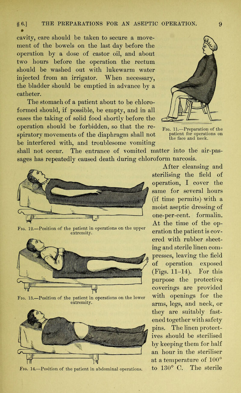 Fig. 11.—Preparation of the patient for operations on the face and neck. cavity, care should be taken to secure a move- ment of the bowels on the last day before the operation by a dose of castor oil, and about two hours before the operation the rectum should be washed out with lukewarm water injected from an irrigator. When necessary, the bladder should be emptied in advance by a catheter. The stomach of a patient about to be chloro- formed should, if possible, be empty, and in all cases the taking of solid food shortly before the operation should be forbidden, so that the re- spiratory movements of the diaphragm shall not be interfered with, and troublesome vomiting shall not occur. The entrance of vomited matter into the air-pas- s has repeatedly caused death during chloroform narcosis. After cleansing and sterilising the field of operation, I cover the same for several hours (if time permits) with a moist aseptic dressing of one-per-cent, formalin. At the time of the op- eration the patient is cov- ered with rubber sheet- ing and sterile linen com- presses, leaving the field of operation exposed (Figs. 11-14). For this purpose the protective coverings are provided with openings for the arms, legs, and neck, or they are suitably fast- ened together with safety pins. The linen protect- ives should be sterilised by keeping them for half an hour in the steriliser at a temperature of 100° Fig. 14.—Position of the patient in abdominal operations. to 130° C. The sterile Fig. 12.—Position of the patient in operations on the upper extremity. Fig. 13.—Position of the patient in operations on the lower extremity.