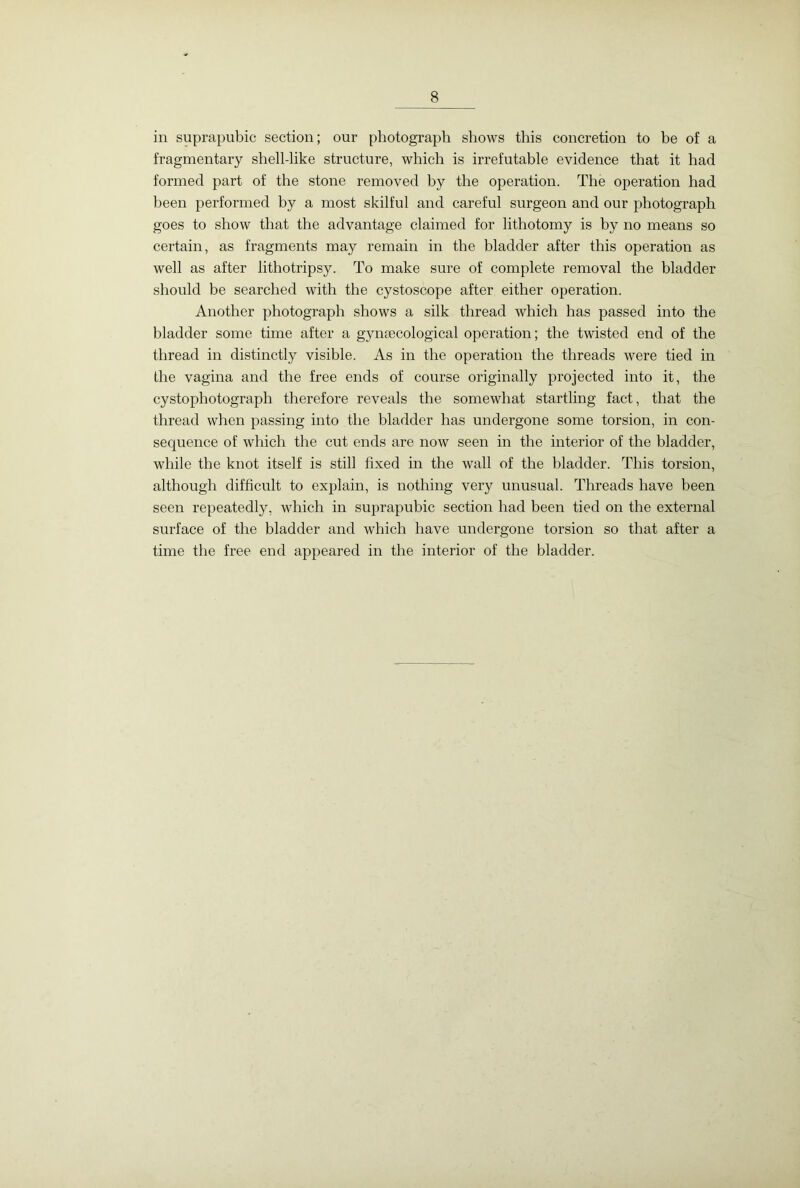 in suprapubic section; our photograph shows this concretion to be of a fragmentary shell-like structure, which is irrefutable evidence that it had formed part of the stone removed by the operation. The operation had been performed by a most skilful and careful surgeon and our photograph goes to show that the advantage claimed for lithotomy is by no means so certain, as fragments may remain in the bladder after this operation as well as after lithotripsy. To make sure of complete removal the bladder should be searched with the cystoscope after either operation. Another photograph shows a silk thread which has passed into the bladder some time after a gynaecological operation; the twisted end of the thread in distinctly visible. As in the operation the threads were tied in the vagina and the free ends of course originally projected into it, the cystophotograph therefore reveals the somewhat startling fact, that the thread when passing into the bladder has undergone some torsion, in con- sequence of which the cut ends are now seen in the interior of the bladder, while the knot itself is still fixed in the wall of the bladder. This torsion, although difficult to explain, is nothing very unusual. Threads have been seen repeatedly, which in suprapubic section had been tied on the external surface of the bladder and which have undergone torsion so that after a time the free end appeared in the interior of the bladder.