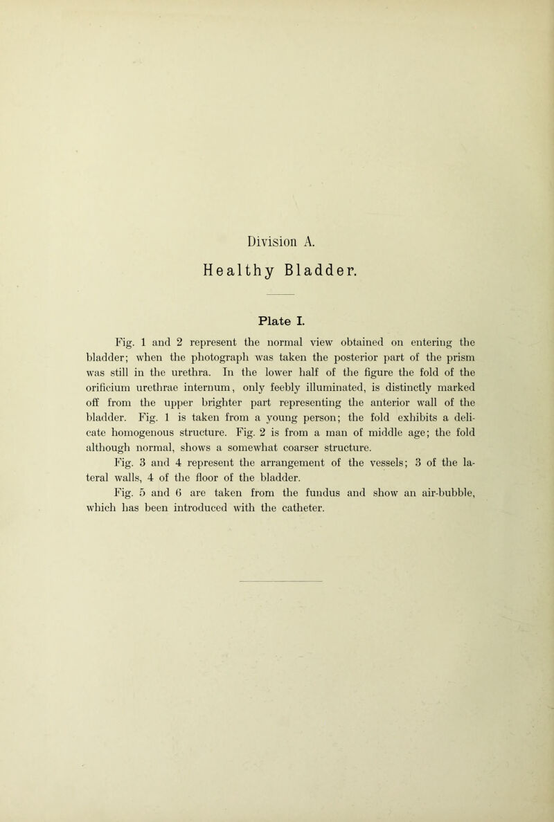 Healthy Bladder. Plate I. Fig. 1 and 2 represent the normal view obtained on entering the bladder; when the photograph was taken the posterior part of the prism was still in the urethra. In the lower half of the figure the fold of the orificium urethrae internum, only feebly illuminated, is distinctly marked off from the upper brighter part representing the anterior wall of the bladder. Fig. 1 is taken from a young person; the fold exhibits a deli- cate homogenous structure. Fig. 2 is from a man of middle age; the fold although normal, shows a somewhat coarser structure. Fig. 3 and 4 represent the arrangement of the vessels; 3 of the la- teral walls, 4 of the floor of the bladder. Fig. 5 and 6 are taken from the fundus and show an air-bubble, which has been introduced with the catheter.