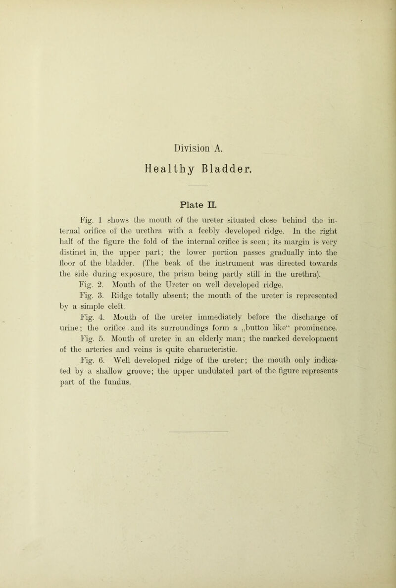 Healthy Bladder. Plate II. Fig. 1 shows the mouth of the ureter situated close behind the in- ternal orifice of the urethra with a feebly developed ridge. In the right half of the figure the fold of the internal orifice is seen; its margin is very distinct in the upper part; the lower portion passes gradually into the floor of the bladder. (The beak of the instrument was directed towards the side during exposure, the prism being partly still in the urethra). Fig. 2. Mouth of the Ureter on well developed ridge. Fig. 3. Ridge totally absent; the mouth of the ureter is represented by a simple cleft. Fig. 4. Mouth of the ureter immediately before the discharge of urine; the orifice and its surroundings form a „button like“ prominence. Fig. 5. Mouth of ureter in an elderly man; the marked development of the arteries and veins is quite characteristic. Fig. 6. Well developed ridge of the ureter; the mouth only indica- ted by a shallow groove; the upper undulated part of the figure represents part of the fundus.