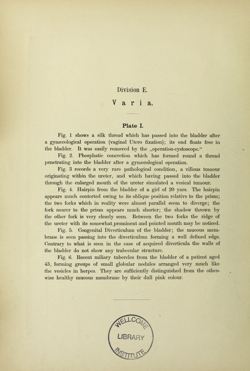 Varia. Plate I. Fig. 1 shows a silk thread which has passed into the bladder after a gynaecological operation (vaginal Utero fixation); its end floats free in the bladder. It was easily removed by the „operation-cystoscope.“ Fig. 2. Phosphatic concretion which has formed round a thread penetrating into the bladder after a gynaecological operation. Fig. 3 records a very rare pathological condition, a villous tumour originating within the ureter, and which having passed into the bladder through the enlarged mouth of the ureter simulated a vesical tumour. Fig. 4. Hairpin from the bladder of a girl of 20 yars. The hairpin appears much contorted owing to its oblique position relative to the prism; the two forks which in reality were almost parallel seem to diverge; the fork nearer to the prism appears much shorter; the shadow thrown by the other fork is very clearly seen. Between the two forks the ridge of the ureter with its somewhat prominent and pointed mouth may he noticed. Fig. 5. Congenital Diverticulum of the bladder; the mucous mem- brane is seen passing into the diverticulum forming a well defined edge. Contrary to what is seen in the case of acquired diverticula the walls of the bladder do not show any trabecular structure. Fig. 6. Recent miliary tubercles from the bladder of a patient aged 43, forming groups of small globular nodules arranged very much like the vesicles in herpes. They are sufficiently distinguished from the other- wise healthy mucous membrane by their dull pink colour. library