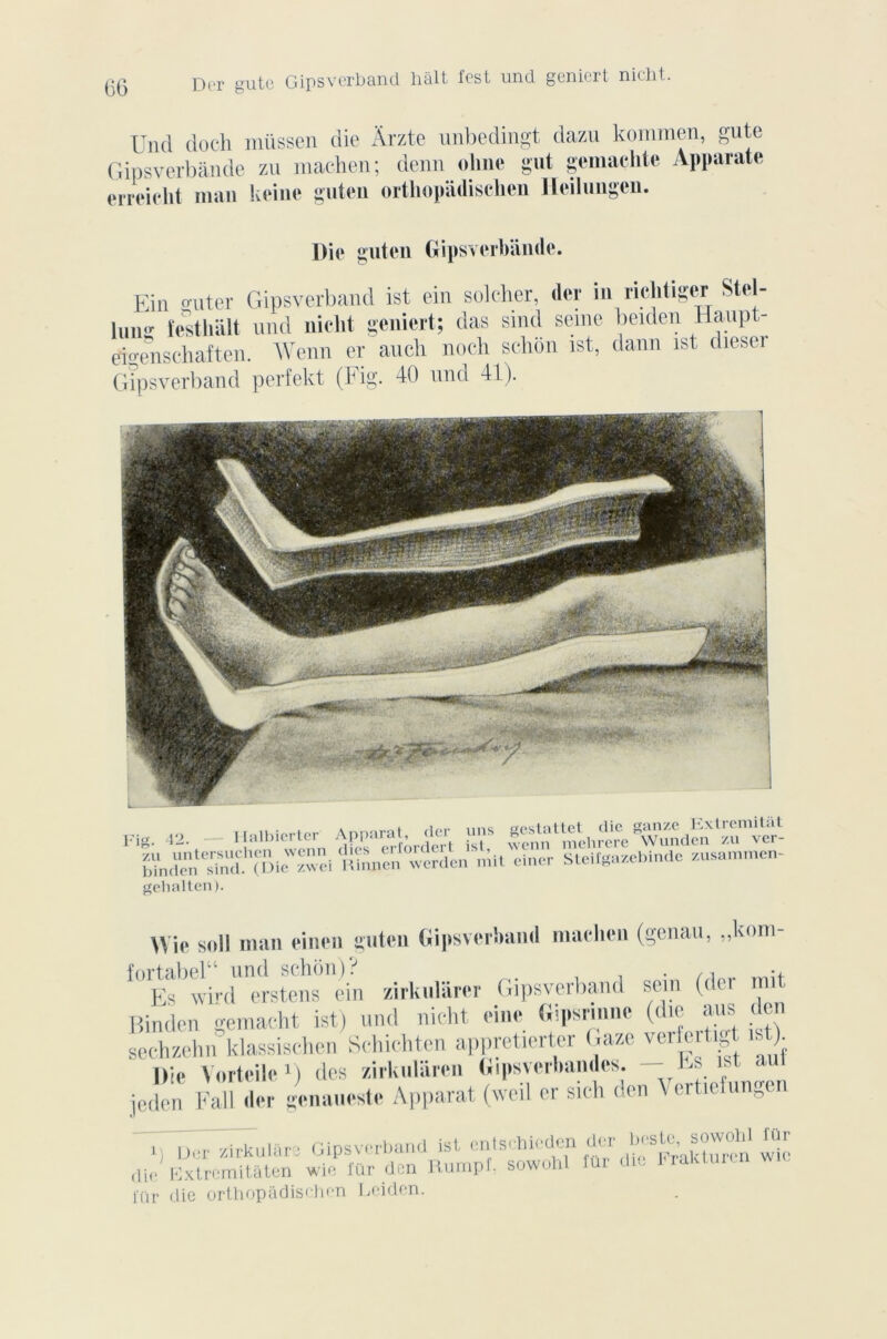 (i(3 Dit gute Gipsverband hait lest und geniert nicht. Und do ch müssen die Àrzte unbedingt dazu konimen, gute Gipsverbânde zu machen; denn oline gut gemaçhte Apparate erreiclit nian keine guten orthopâdisclien Heilungen. Die guten Gipsverbânde. Ein o-uter Gipsverband ist ein solcher, (1er in richtigcr Stel- lun«r festlûilt und niclit geniert; das smd seine beiden Haupt- eio-enschaften. Wenn er au ch noch schôn ist, dann ist diesel Gipsverband perfekt (Fig. 40 und 41). Fig. 42. — Halbierter zu untersuchcn wenn binden sind. (Die zwei gehalten ). Apparat, der uns dies erfordert ist, Ri mien werden m gestattet die ganze Extremitut wenn melirere Wunden zu ver- it einer Steilgazebinde zusammen- Wie soll man einen guten Gipsverband machen (genau, ,,Koiu fortabelu und schôn)? . ., Es wird erstens ein zirkulârer Gipsverband sein (der mit Binden gemacht ist) und nicht einc Gipsrinnc (die aus < eu sechzehn klassischen Schichten appretierter Gaze verfertigt ist) Die Vortcile1) des zirkuliircii Gipsvcrbandes. --lis ist aut jeden genaueste Apparat (weil er sich den Vcrticfungen i, Der zirkulâro Gipsverband ist cntschiedcn die Extremitâten wie für den Rumpf. sowohl l'iir die orthopadischen Leiden. der beste, sowohl für die Frakturcn für wie