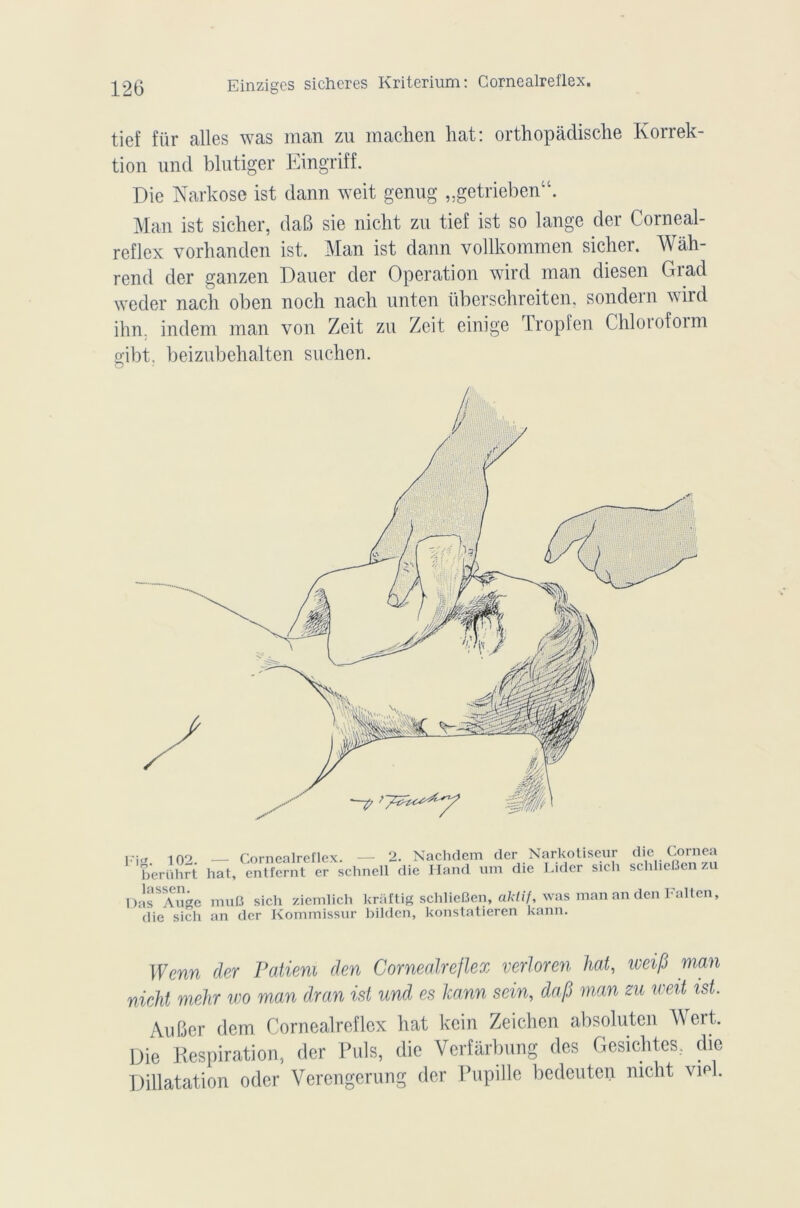 tief für ailes was man zu machen liât: orthopâdisclie Korrek- tion une! blutiger Eingriff. Die Narkose ist dann weit genug „getriebenu. Man ist siclier, daB sie nicht zu tief ist so lange der Corneal- reflex vorhanden ist. Man ist dann vollkommen sicher. Wâh- rend der ganzen Dauer der Operation wird man diesen Giad weder nach oben nocli nach unten überschreiten, sondera wird ihn. indem man von Zeit zu Zeit einige Tropfen Chiotofoim oibt. beizubehalten suchen. o Fi. 102. — Cornealreflex. — 2. Nachdem der Narkotiseur berührt hat, entfernt er schncll die Hand um die Lider sic î die Cornea schlieiîen zu oirïïge muB sich ziemlich krâftig schlieiîen, akiif, was man an den Falten, die sich an der Kommissur bilden, konstatieren kann. Wenn der Patieni den Cornealreflex verloren liai, toeifi man nicht mehr wo man dran ist und es kann sein, dap man zu weit ist. Au Ber dem Cornealreflex hat kein Zeichen absoluten Wert. Die Respiration, der Puis, die Verfârbung des Gesichtes.. die Dillatation oder Verengerung der Pupille bedeuten nicht viel.