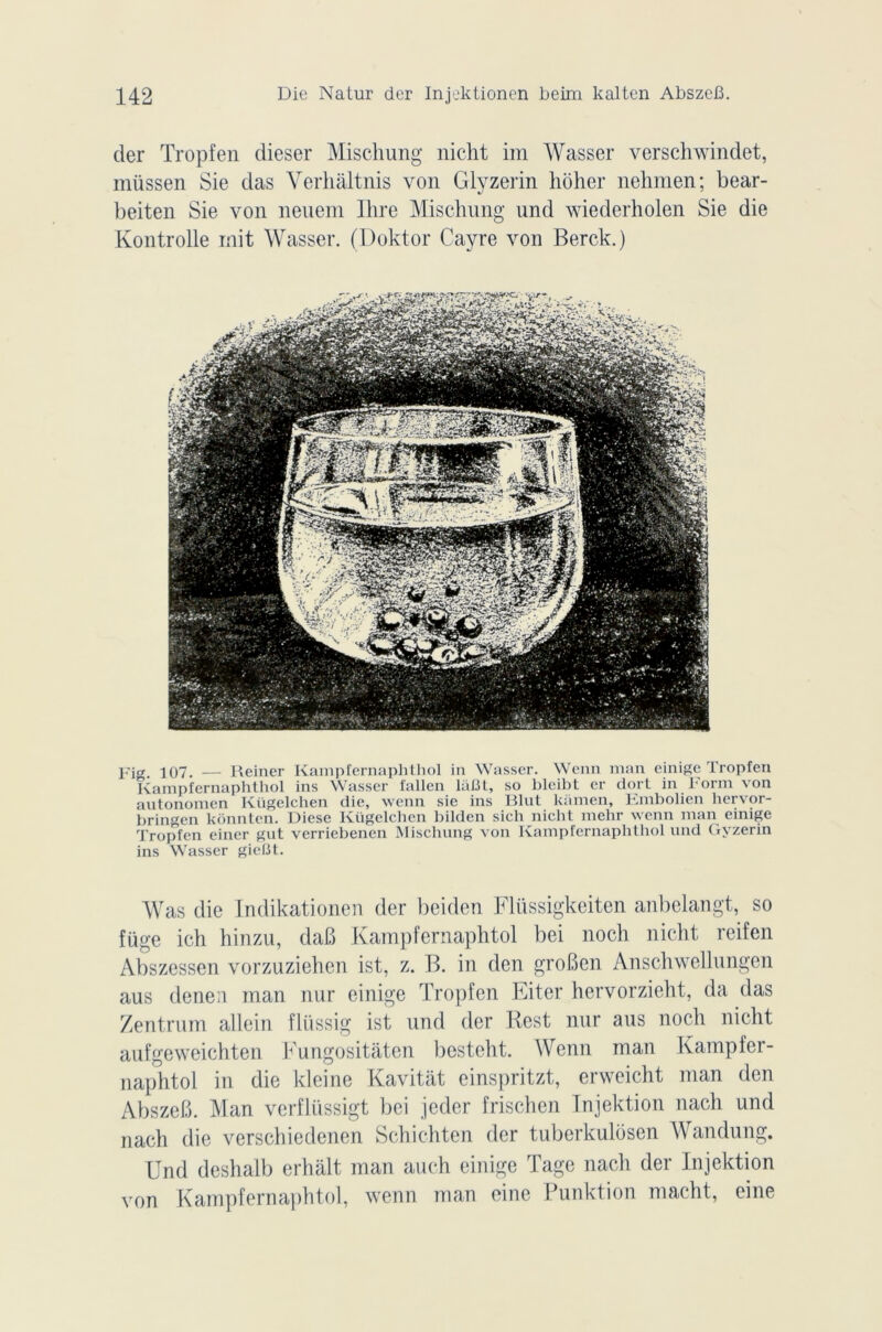 der Tropfen dieser Mischung nicht im Wasser verschwindet, müssen Sie das Yerhâltnis von Glyzerin hdher nehmen; bear- beiten Sie von neuem Ihre Mischung und wiederholen Sie die Kontrolle mit Wasser. (Doktor Cayre von Berck.) Fig. 107. — Reiner Kampfernaplithol in Wasser. Wenn man einige Tropfen Kampfernaphthol ins Wasser fallen laBt, so blcibt er dort in Form von autonomen Kügelchen die, wenn sic ins Blut kamen, Embolien hervor- bringen kônnten. Diese Kügelchen bilden sicli nicht mehr wenn man einige Tropfen einer gut verriebenen Mischung von Kampfernaphthol und Gyzerin ins Wasser gielît. Was die Indikationen der beiden Fliissigkeiten anbelangt, so füge ich hinzu, daB Kampfernaphtol bei noch nicht reifen Abszessen vorzuziehen ist, z. B. in den groBen Anschwellnngen aus denen man nur einige Tropfen Eiter hervorzieht, da das Zentrum allein flüssig ist und der Best nur aus noch nicht aufgeweichten Fungositâten besteht. Wenn man Kampfer- naphtol in die kleine Kavitât einspritzt, erweicht man den AbszeB. Man verflüssigt bei jeder frischen Injektion nach und nach die verschiedenen Schichten der tuberkulosen Wandung. Und deshalb erhâlt man auch einige Tage nach der Injektion von Kampfernaphtol, wenn man eine Punktion macht, eine