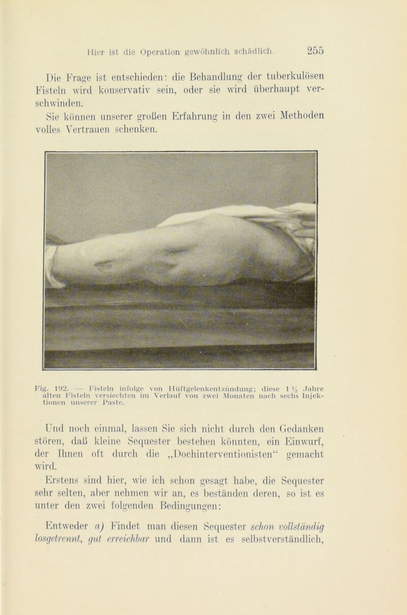 Die Frage ist entschieden; die Behandlung der tuberkulôsen Fisteln wird konservativ sein, oder sie wird iiberhaupt ver- schwinden. Sie kônnen unserer groBen Erfahrung in den zwei Methoden voiles Vertrauen sclienken. Fig. 192. —: Fisteln infolge von Hüftgelenkentzündung; diese 1% Jahre alten Fisteln versiechten im Verlauf von zwei Monaten nach sechs Injek- tionen unserer Faste. Und noch einmal, lassen Sie sich nicht dnrch den Gedanken stôren, daB kleinc Sequester bestehen konnten, ein Einwurf, der llmcn oft durcit die „Dochinterventionisten“ gemacht wird. Erstens sind hier, wie ich schon gesagt liabe, die Sequester sehr selten, aber nehmen wir an, es bestanden deren, so ist es unter den zwei folgenden Bedingungen: Entweder a) Findet inan diesen Sequester schon vollstandig losgetrennt, gui erreichbar und daim ist es selbstverstandlich,