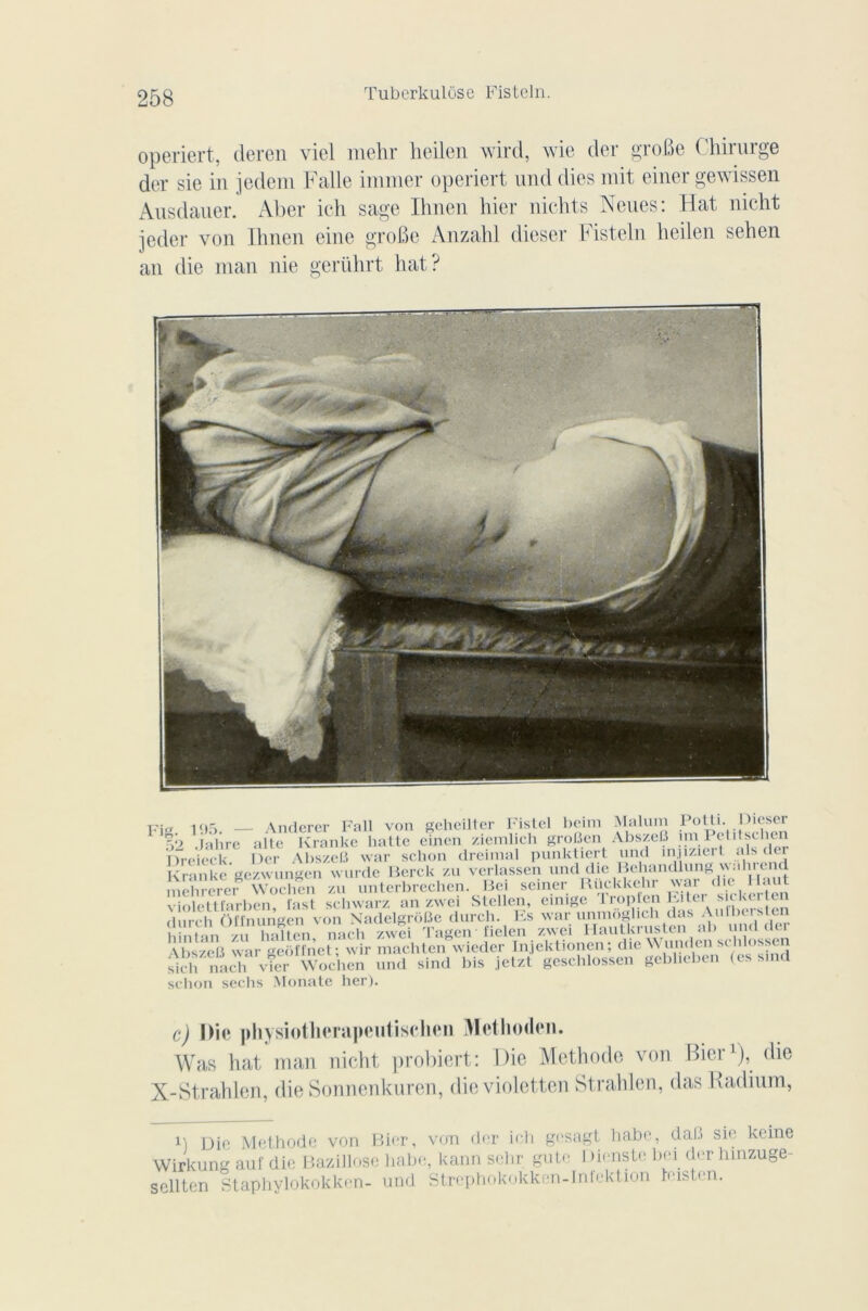 Tuberkulose Fisteln. operiert, deren viel mehr hcilen wird, wie der groBe Chirurge der sie in jedem Falle immer operiert und dies mit einer gewissen Ausdauer. Aber ieh sage Ihnen hier nichts Neues: Hat nicht jeder von Ihnen eine groBe Anzahl dieser Fisteln heilen sehen an die man nie gerührt hat? rifr 105 — Anderer Fall von geheilter Fistel beim Malum Potti. Dieser 52 Jahre alte Kranke batte einen ziemlich groBen AbszeB îm PetOscben Dreieck Der AbszeB war scbon drcimal punktiert und m.jiziert als der Kranke’gezwungen wurdc Berck zu verlassen und die Behandlung wahi end mchrerer Woclicn zu unterbrechen. Bel seiner Rftckkehr war die Haut violettfarben, fast schwarz an zwei Stellen, einige frppfen Kiter sit kei te durch üffnungen von Nadelgrdüe durch. Ks war unnioglu h dus . h ntan zu Zlten nach zwei Tagen fielen zwei Hautkrusten al» ijndder AbszeB war geôffnet; wir machten wieder Injektionen; die AVunden scblosscn âch nach vîer Wochen und sind bis jetzt geschlossen geblieben (es s.nd scbon sechs Monate ber). c) Die physiotherapeutisclicn Metlioden. Was hat man nicht probiert : Die Méthode von Hier1), die X-Strahlen, die Sonnenkuren, dievioletten Strahlen, das Radium, I'i Die Méthode von Bier, von der ich gesagt habe, daB sie keine Wirkung auf die Bazillosc habe, kann sehr gute I )ienste bei der hinzuge- sellten Staphylokokken- und Strephokokken-Infektion husten.