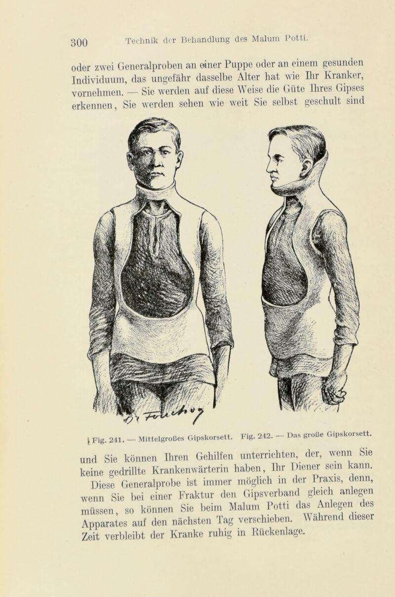Technik der Behandlung des Malum Potti. oder zwei Generalproben an orner Puppe oder an einem gesunden Individunm, das ungefâhr dasselbe Alter bat wie Bir Kranker, vornehmen. — Sie werden anf diese Weise die Giite llires Gipses erkennen, Sie werden selien wie weit Sie selbst geschult sind k Fig. 241. - MittelgroBes Gipskorsett. Fig. 242. - Das groBe Gipskorsett. und Sie konnen Ihron Gehilfen unterrichten, dei, v^enn Sie keine gedrillte Krankenwârterin haben, Ihr Diener sein kann. Diese Generalprobe ist immer môglich in der Praxis, demi, wenn Sie bei einer Fraktur den Gipsverband gleich anlegen müssen, so konnen Sie beim Malum Potti das Anlegen des Apparates auf den nâchsten Tag verschieben. Mi ahrend dieser Zeit verblcibt der Kranke ruhig in Rückenlage.
