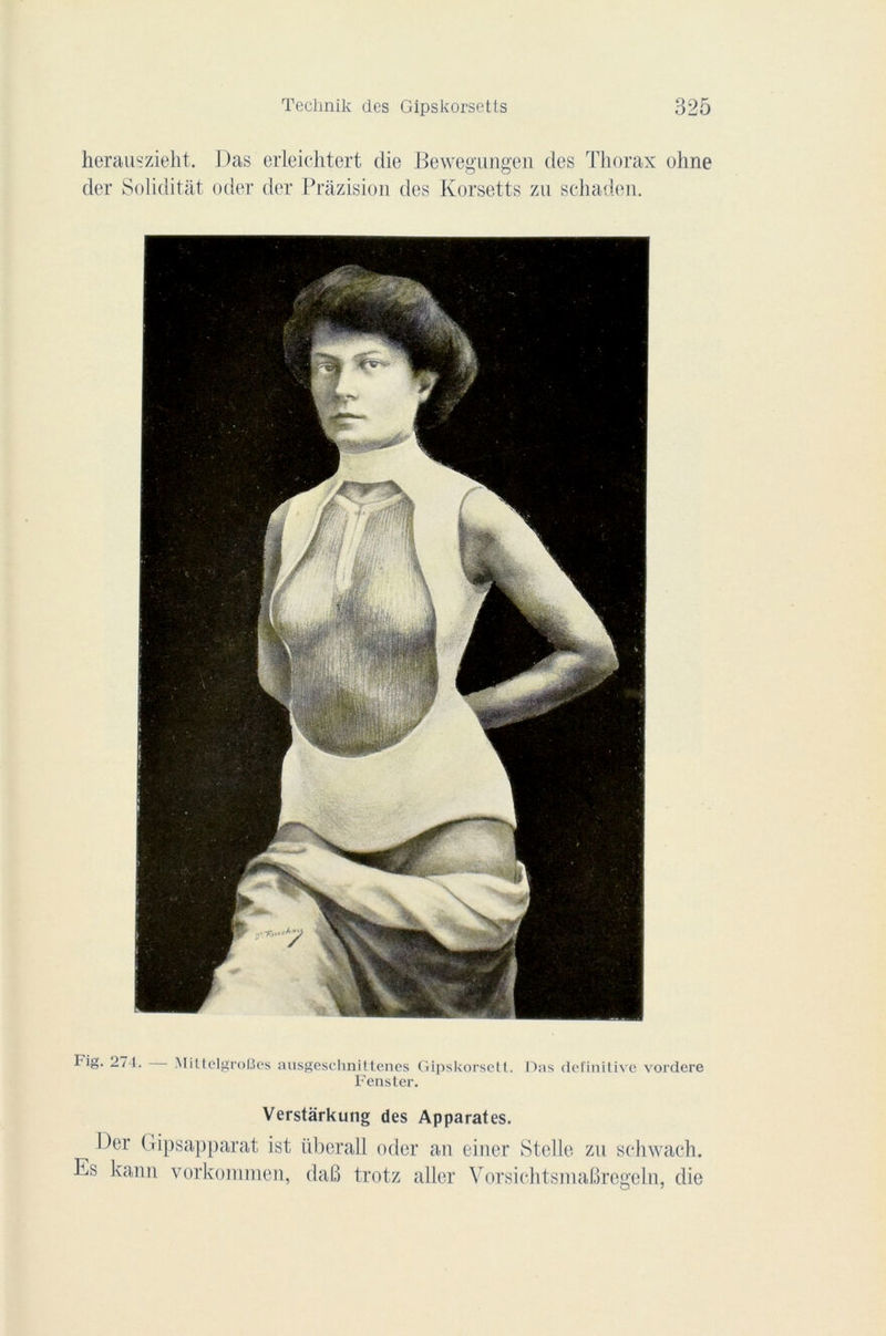 herauszieht. Das erleichtert die Bewegungen des Thorax oline der Soliditât oder der Prâzision des Korsetts zu schaden. Fig. 27 t. MittelgroBes ausgeschnittenes Gipskorsett. Das definitive vordere Fenster. Es Verstârkung des Apparates. Der (lipsapparat ist übcrall oder an einer Stelle zn schwach. kann vorkommen, daB trotz aller VorsichtsmaBregeln, die