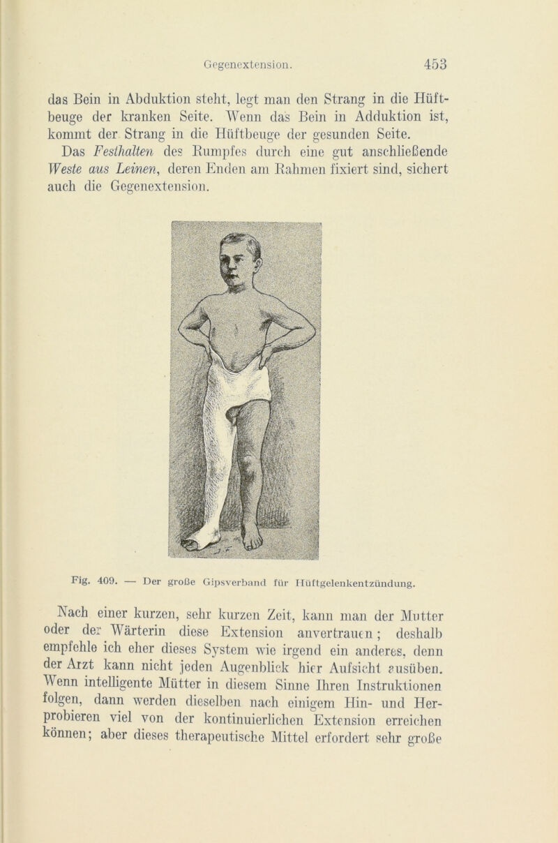 cia s Bein in Abduktion steht, legt man den Strang in die Hüft- beuge der kranken Seite. Wenn das Bein in Adduktion ist, kommt der Strang in die Hüftbeuge der gesunden Seite. Das Festhalten des Knmpfes durch eine gut ansehliefiende Weste ans Leinen, deren Enden am Bahmen fixiert sind, sichert auch die Gegenextension. Fig. 409. — Der groBe Gipsverband für Hüftgelenkentzündung. Nach einer knrzen, sehr kurzen Zeit, kann man der Mutter oder der Wàrterin diese Extension anvertrancn ; deshalb empfehle ich eher dieses System wie irgend ein anderes, denn der Arzt kann nicht jeden Augenblick hier Aufsicht ausüben. Wenn intelligente Mütter in diesem Sinne Ihren Instruktionen folgen, dann werclen dieselben nach einigem Hin- und Her- probieren viel von der kontinuierlichen Extension erreichen konnen ; aber dieses therapeutische Mittel erfordert sehr grobe